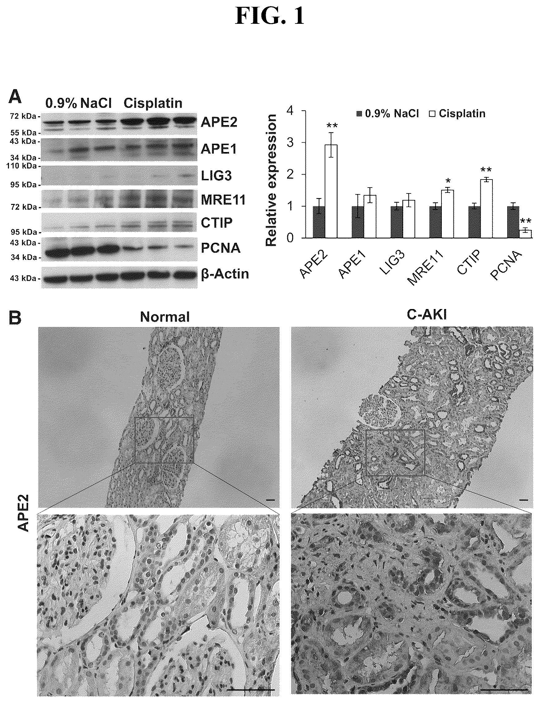 Patent US12460207 — Inhibiting APE2 expression in a subject treated with a drug agent that causes increased APE2 expression — Figure 1