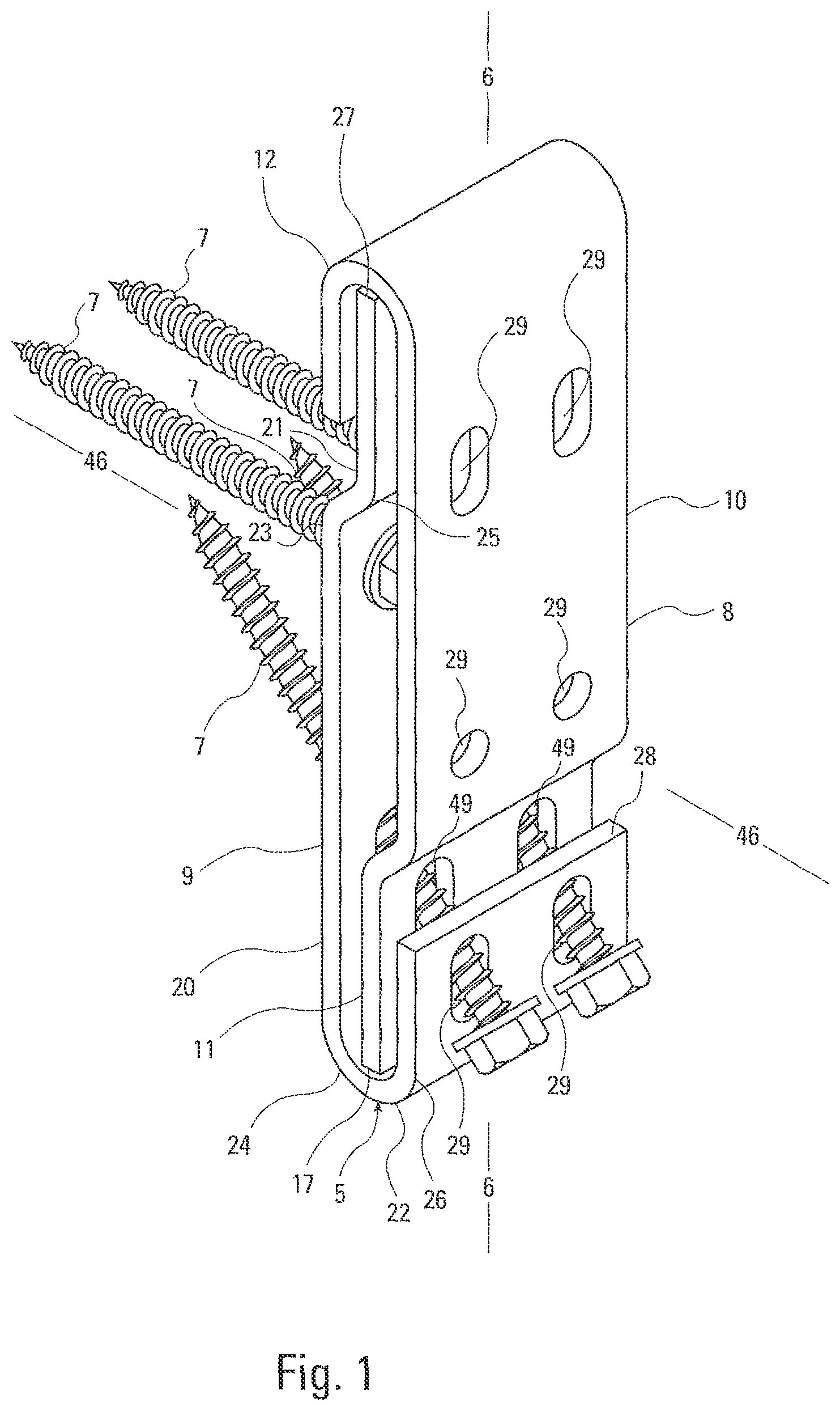 Patent US12460406 Figure 1 – Concealed hanger