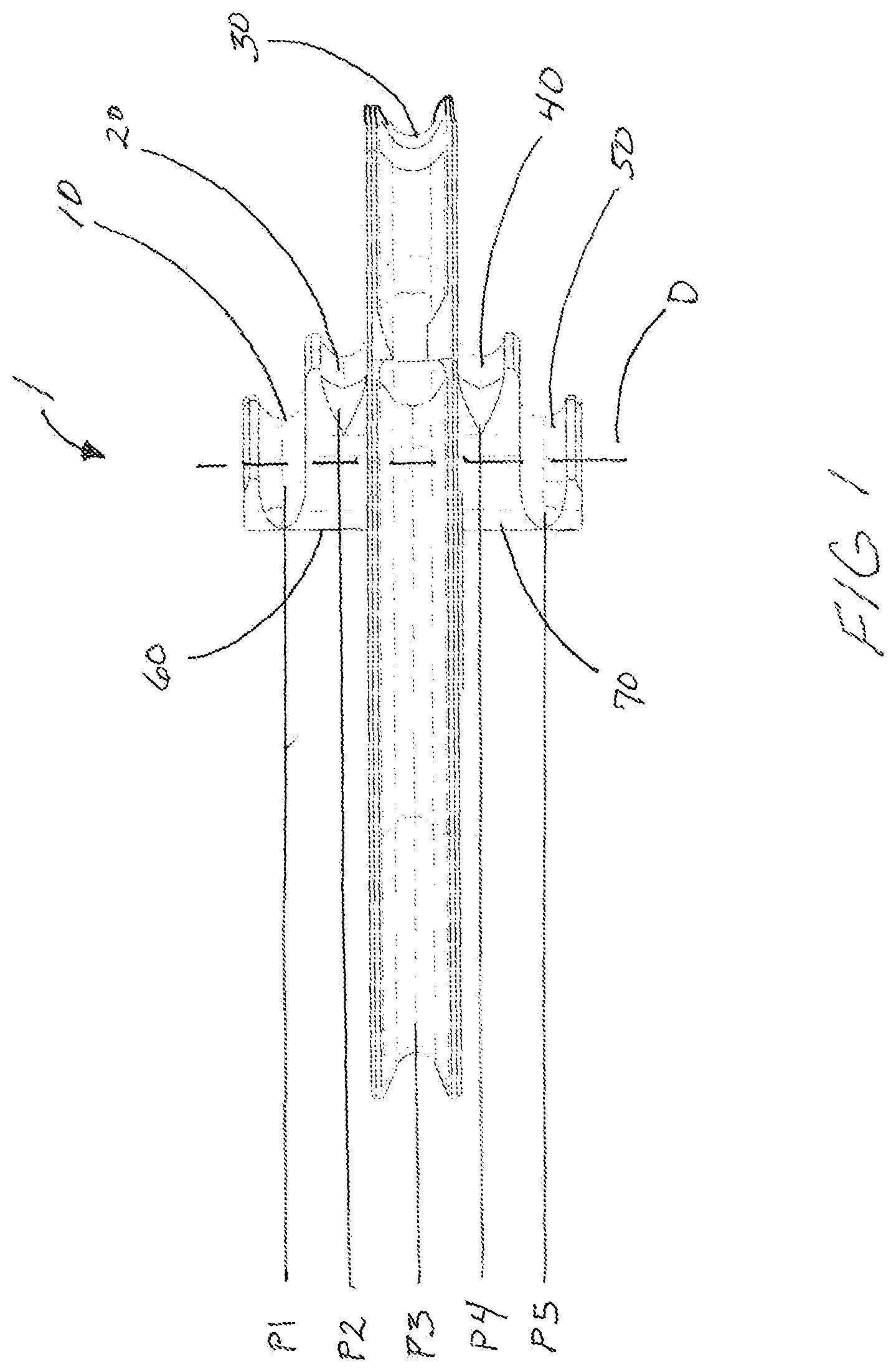 Patent US12460891 — Bow cam having unique cable journals — Figure 1