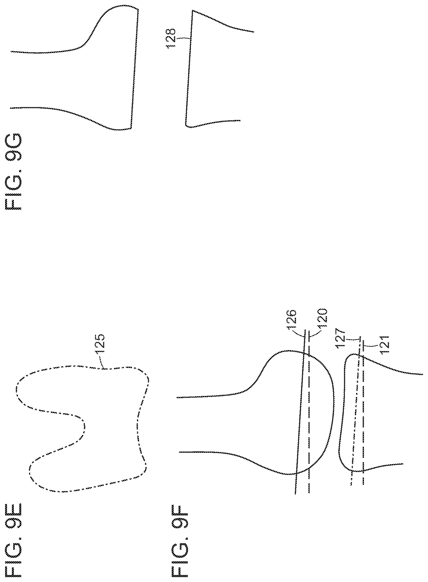 Patent US12472000 Figure 13 – Augmented reality system for monitoring size and laterality of physical implants during surgery and for billing and invoicing