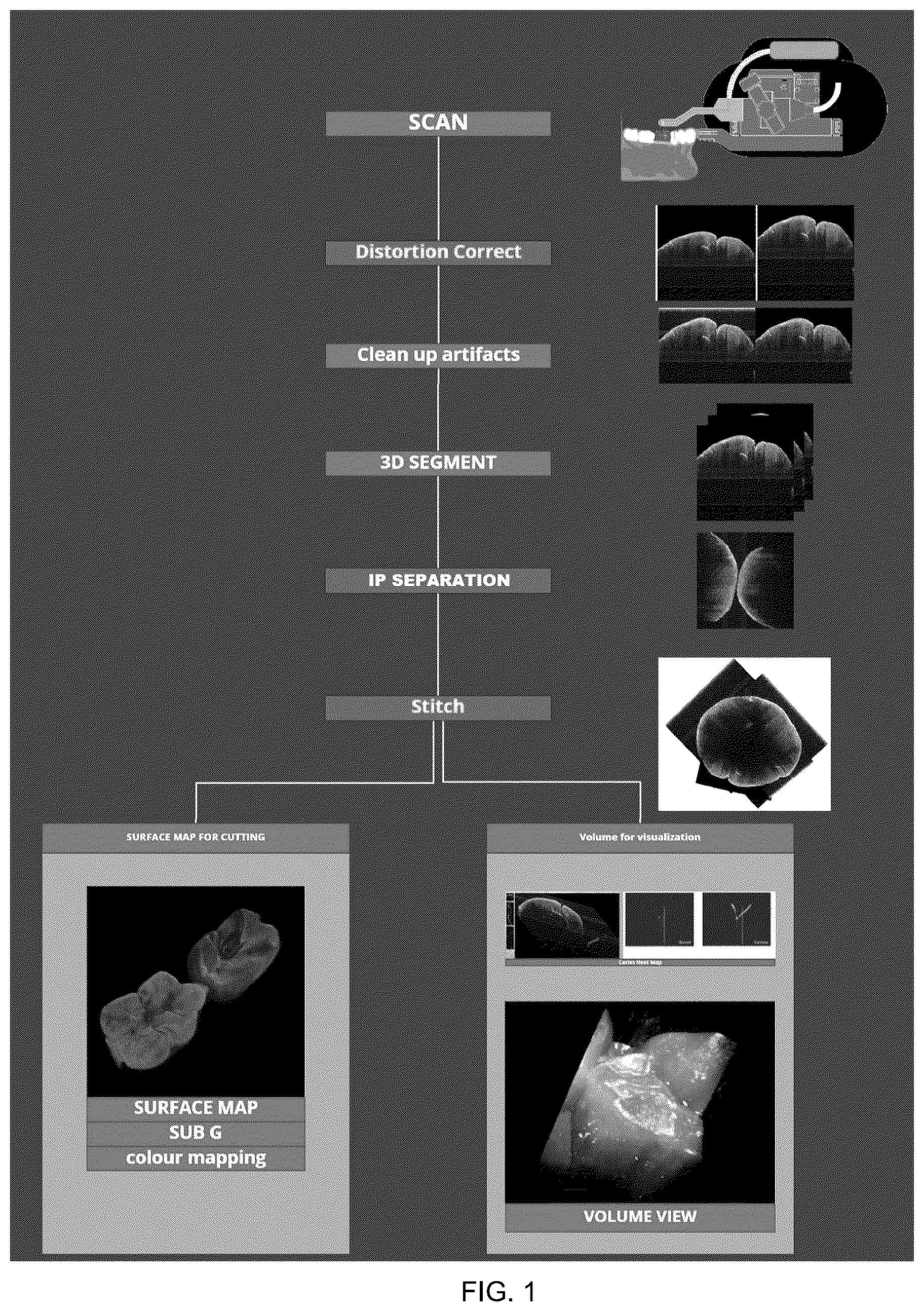 Patent US12472041 — Optical coherence tomography for intra-oral scanning — Figure 1