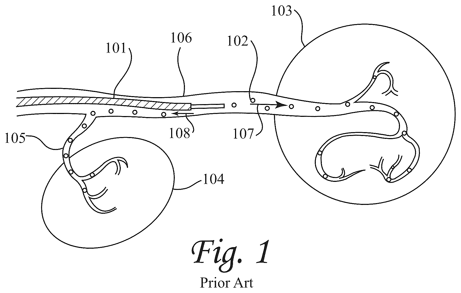 Patent US12472052 — Dynamic microvalve protection device — Figure 1