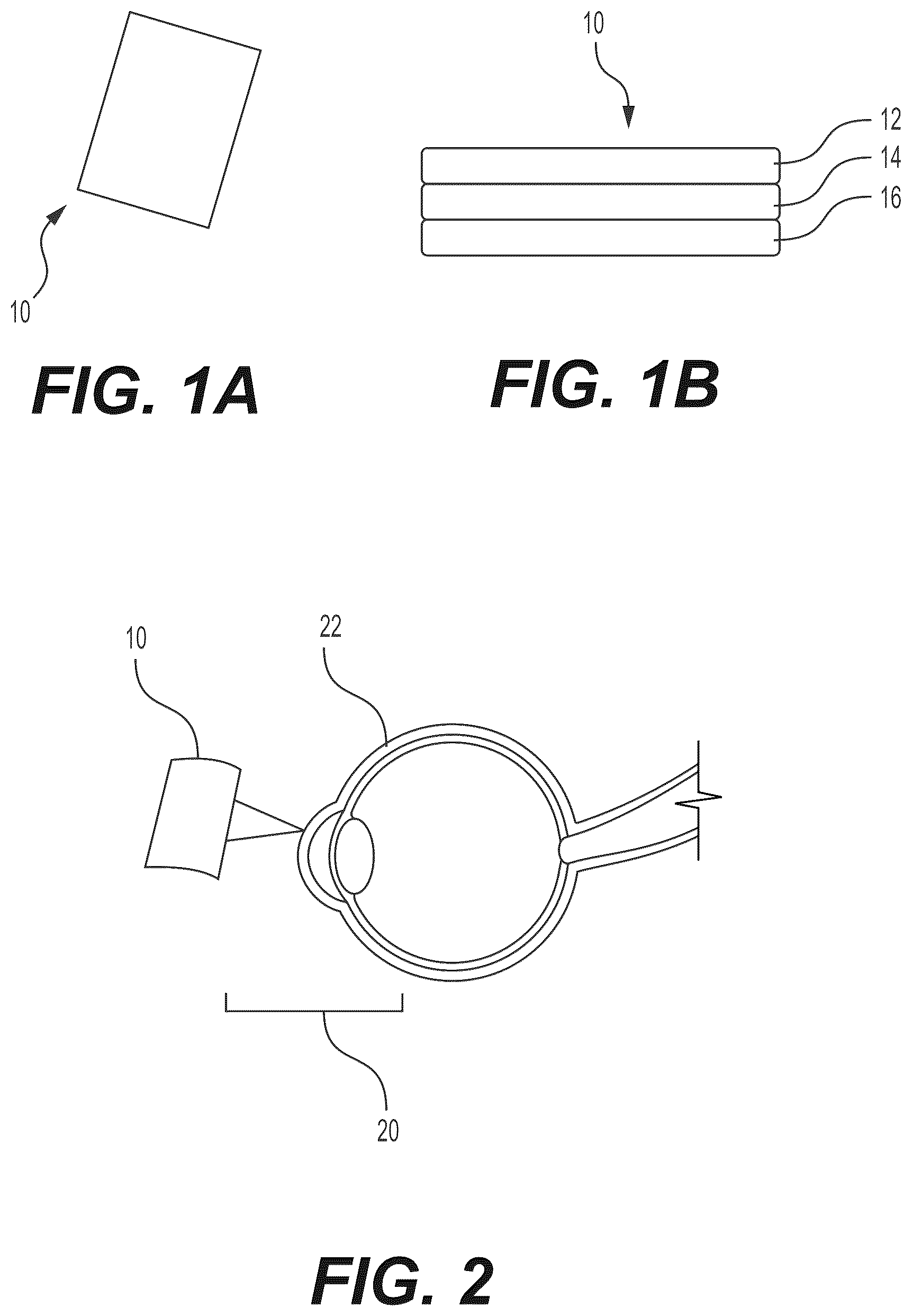 Patent US12472054 — Inductive matrix for functional ocular surface reconstruction — Figure 1