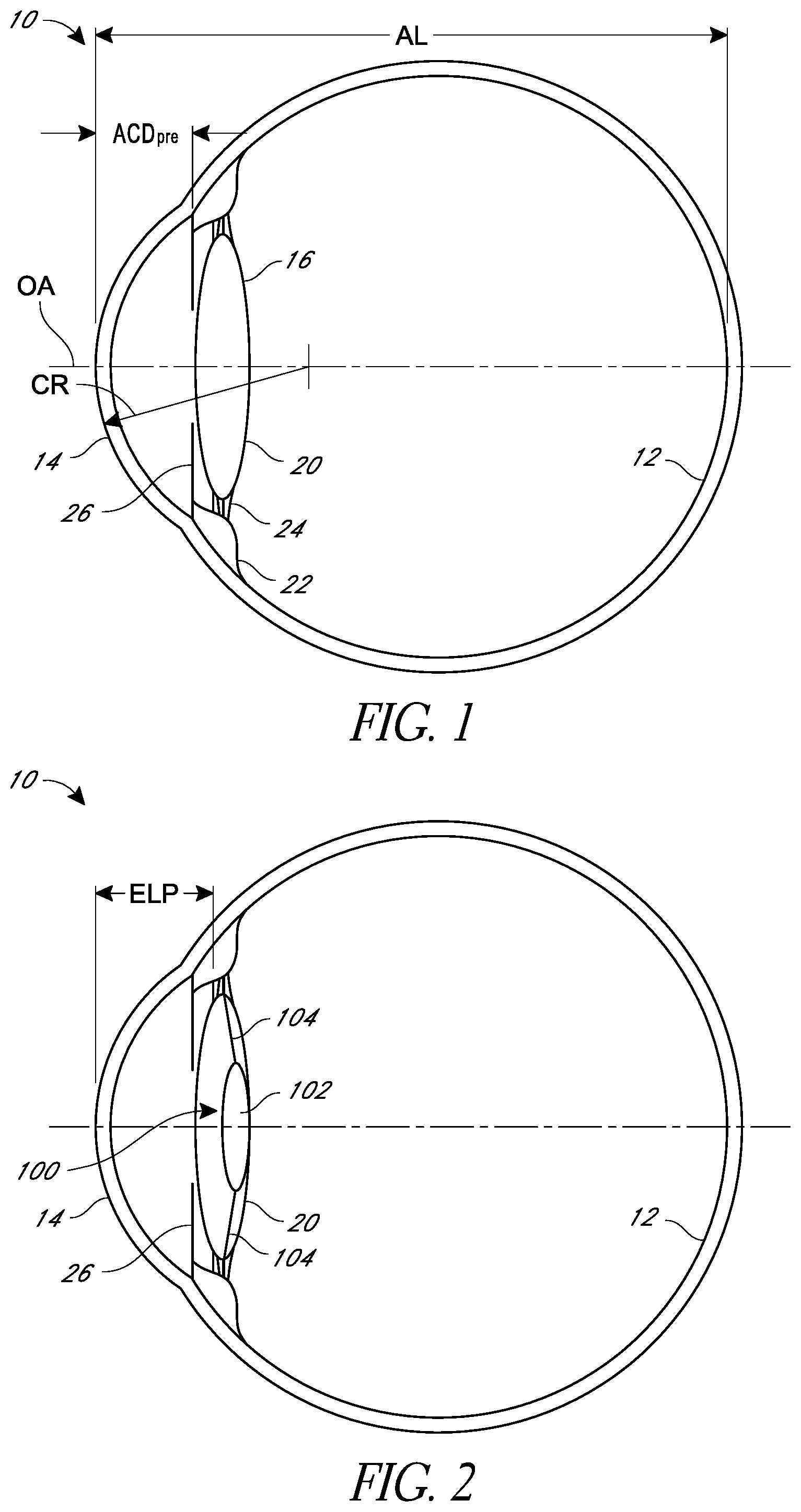 Patent US12472056 Figure 1 – Ophthalmic devices, system and methods that improve peripheral vision