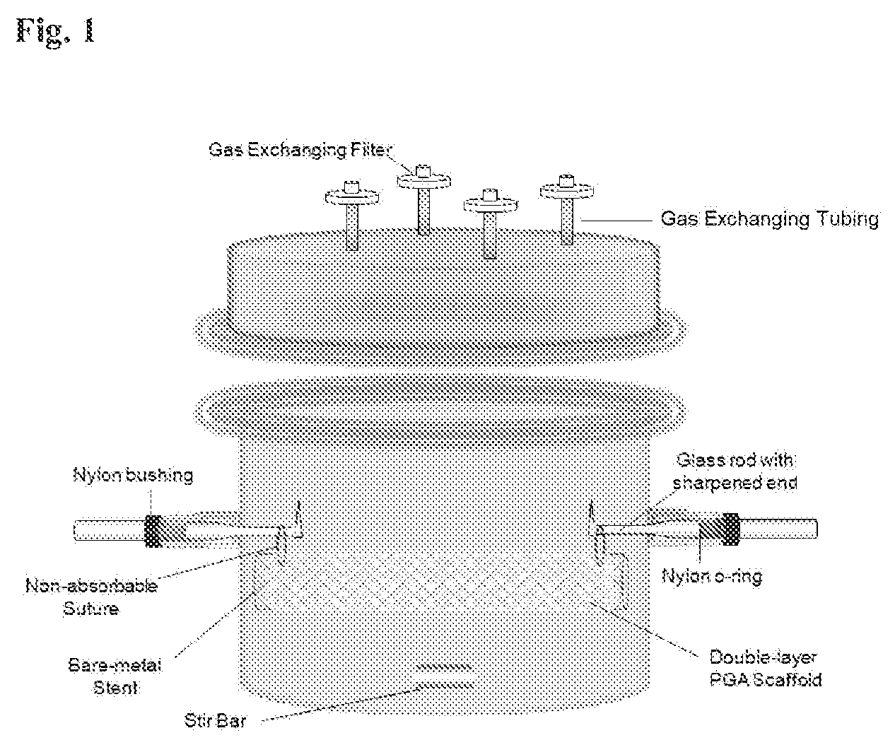 Patent US12472057 — Tubular prostheses — Figure 1