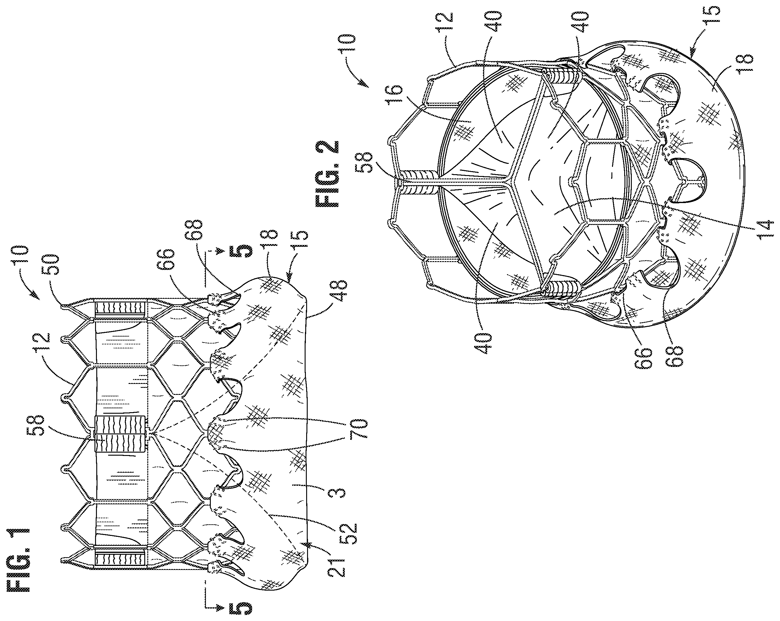 Patent US12472058 — Skirt assembly for implantable prosthetic valve — Figure 1