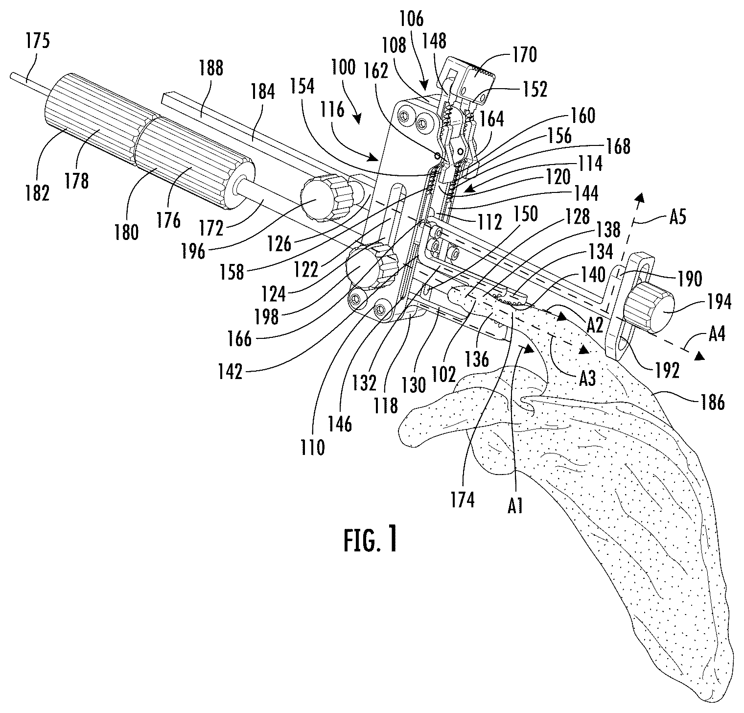 Patent US12472065 — Systems and methods of shoulder implant surgical guide — Figure 1