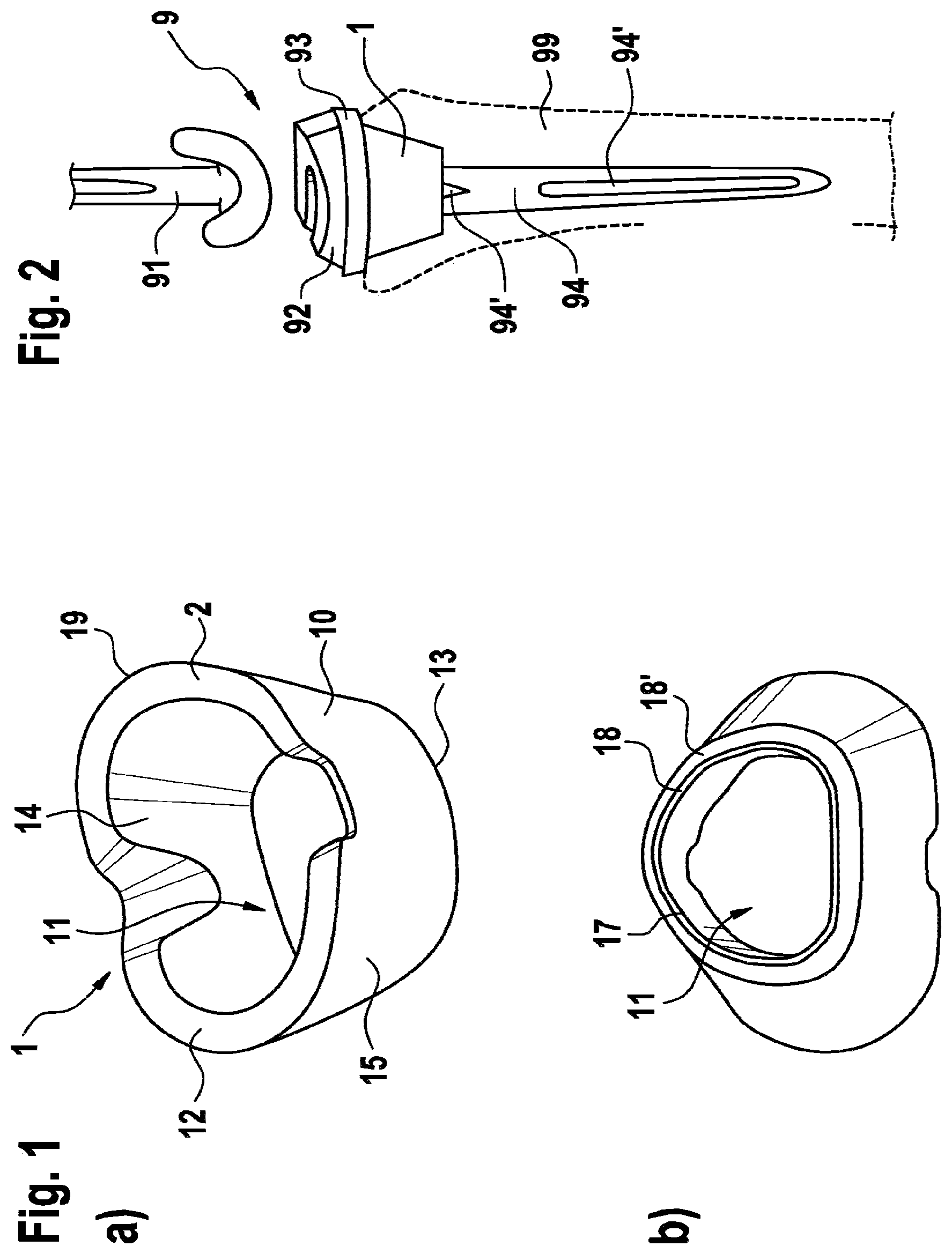 Patent US12472066 — Hollow sleeve augment device and tool — Figure 1