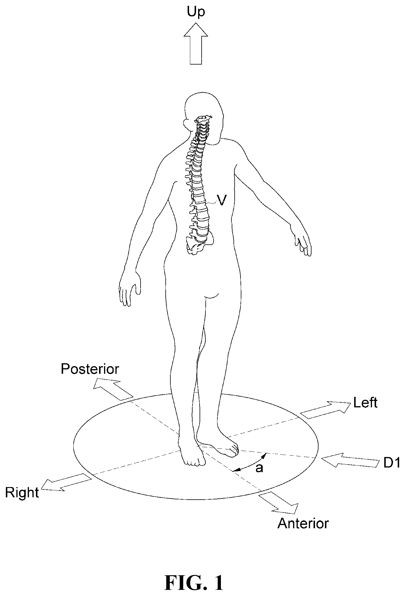 Patent US12472076 — Oblique lateral insertion-type intervertebral cage — Figure 1