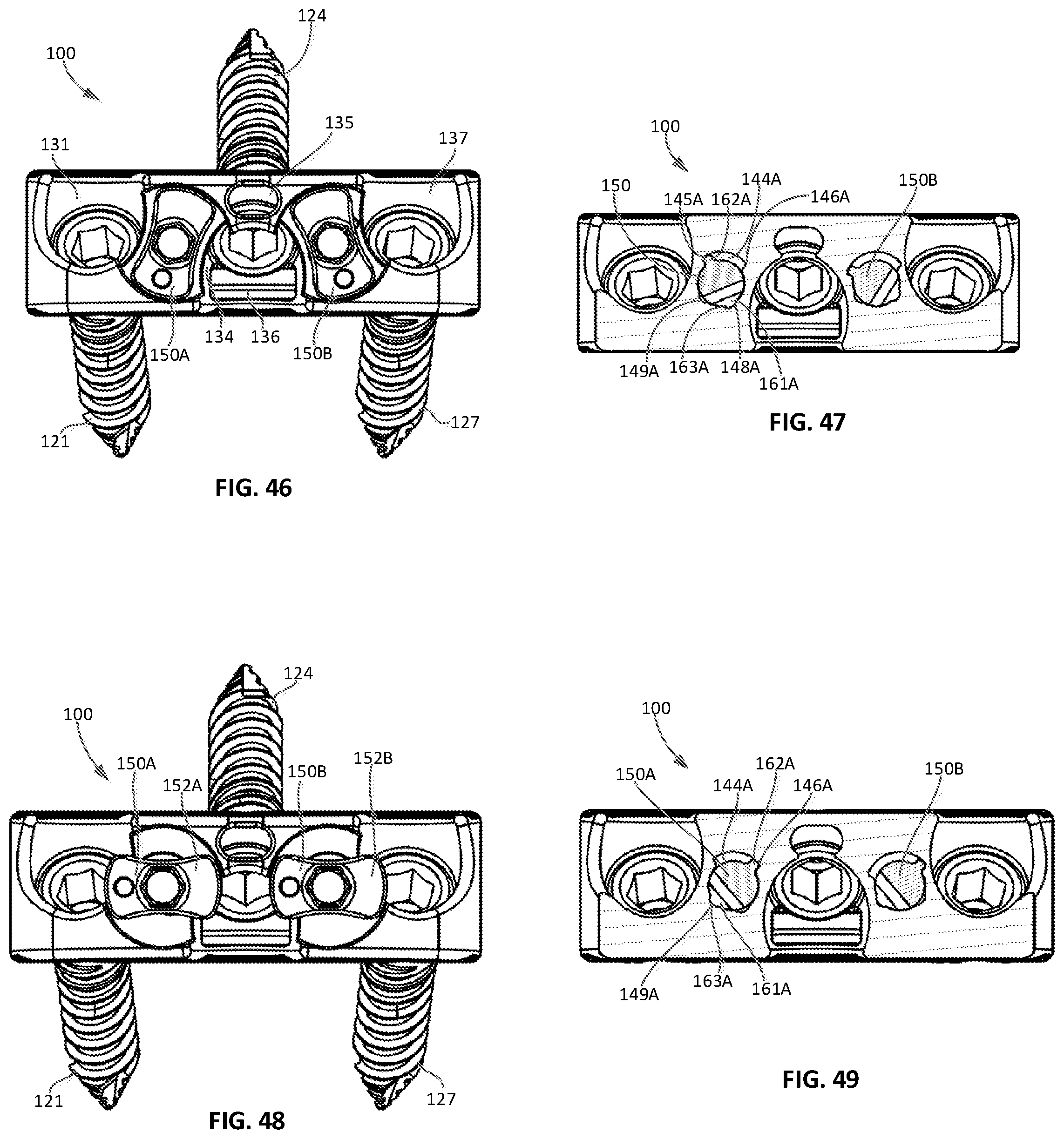 Patent US12472079 Figure 16 – Interbody implants and instrumentation