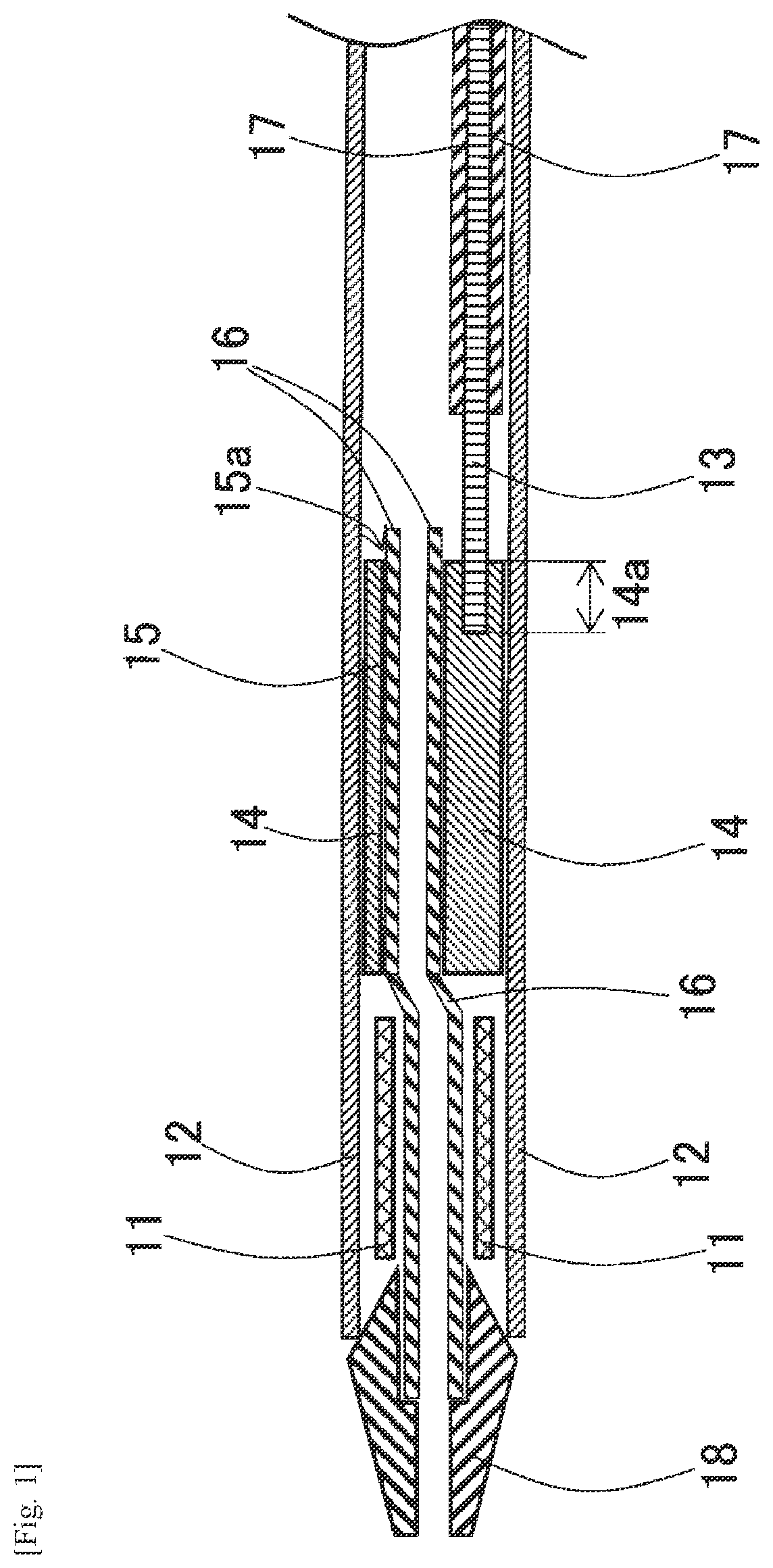 Patent US12472083 — Medical tubular body delivering device — Figure 1