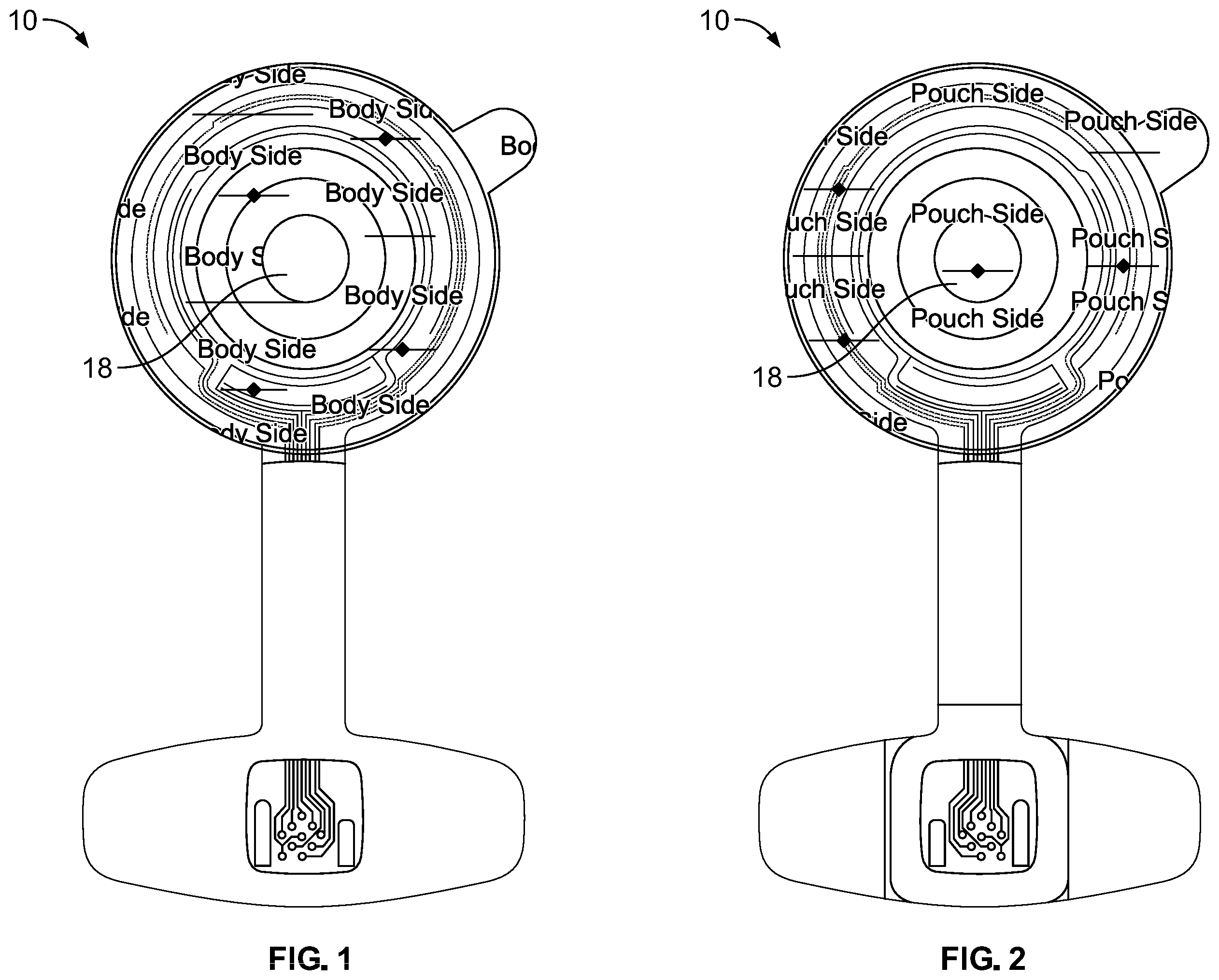 Patent US12472085 — Double-sided sensor device for ostomy leak detection system — Figure 1