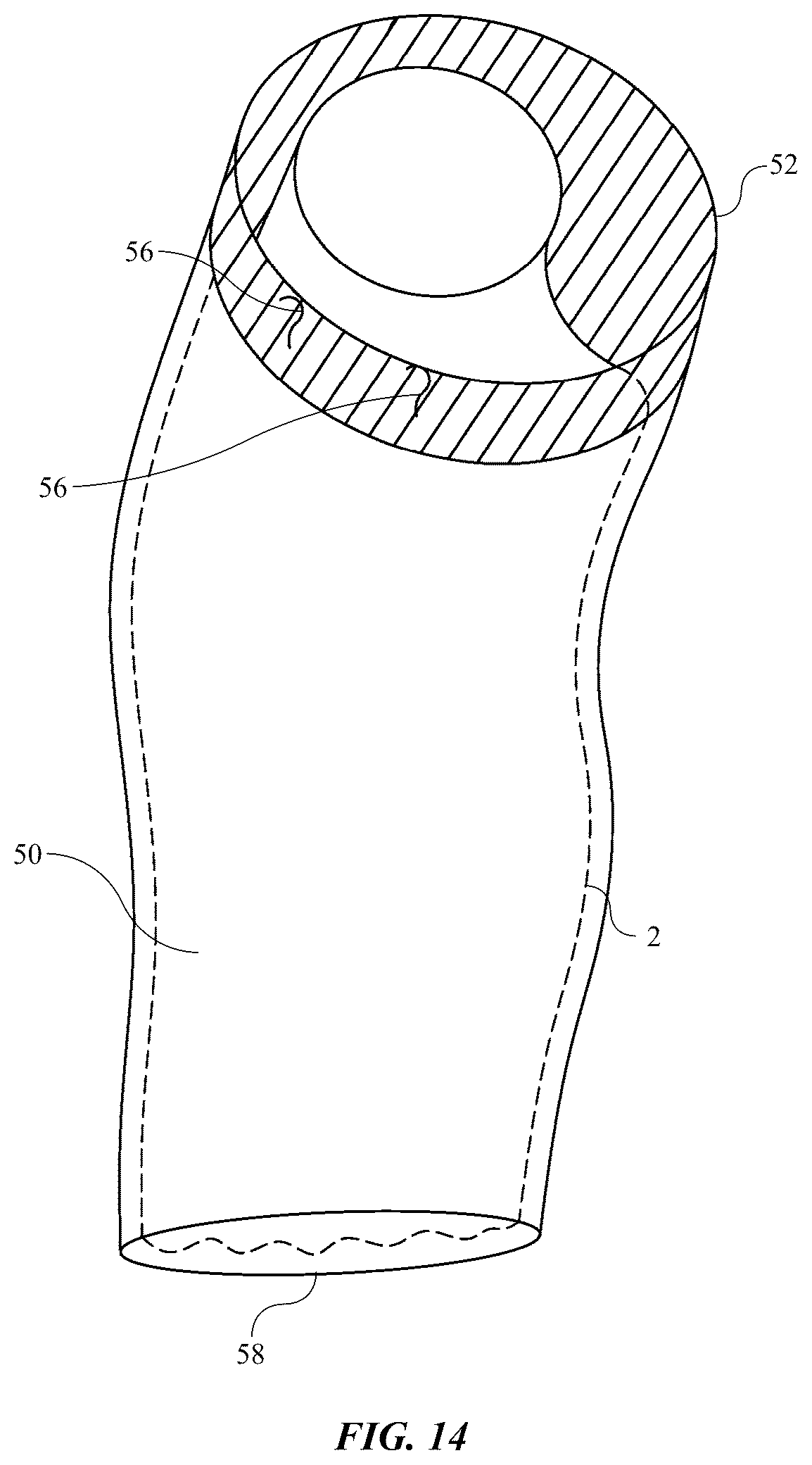 Patent US12472086 Figure 11 – Wearable urinary collection apparatus