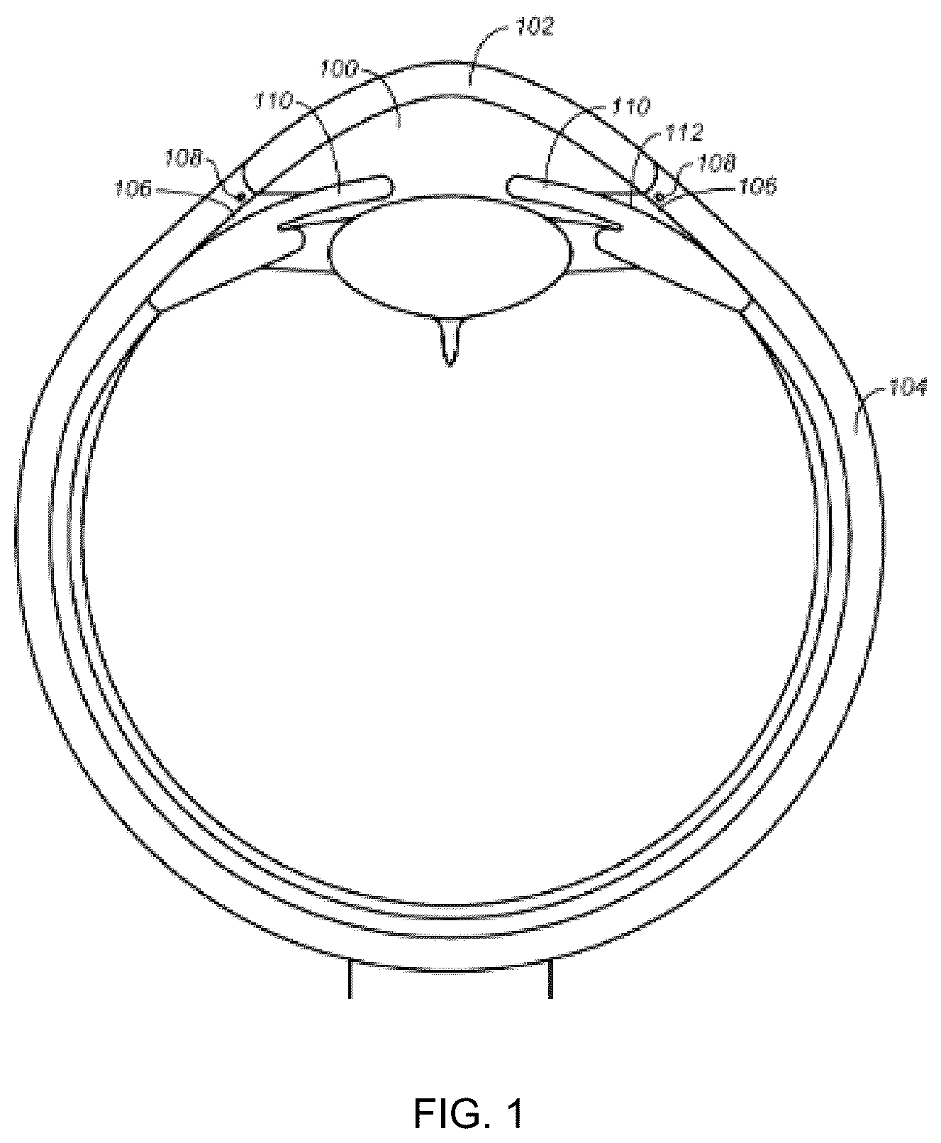 Patent US12472099 — Medical device and ocular implant for treatment of ocular disorders — Figure 1