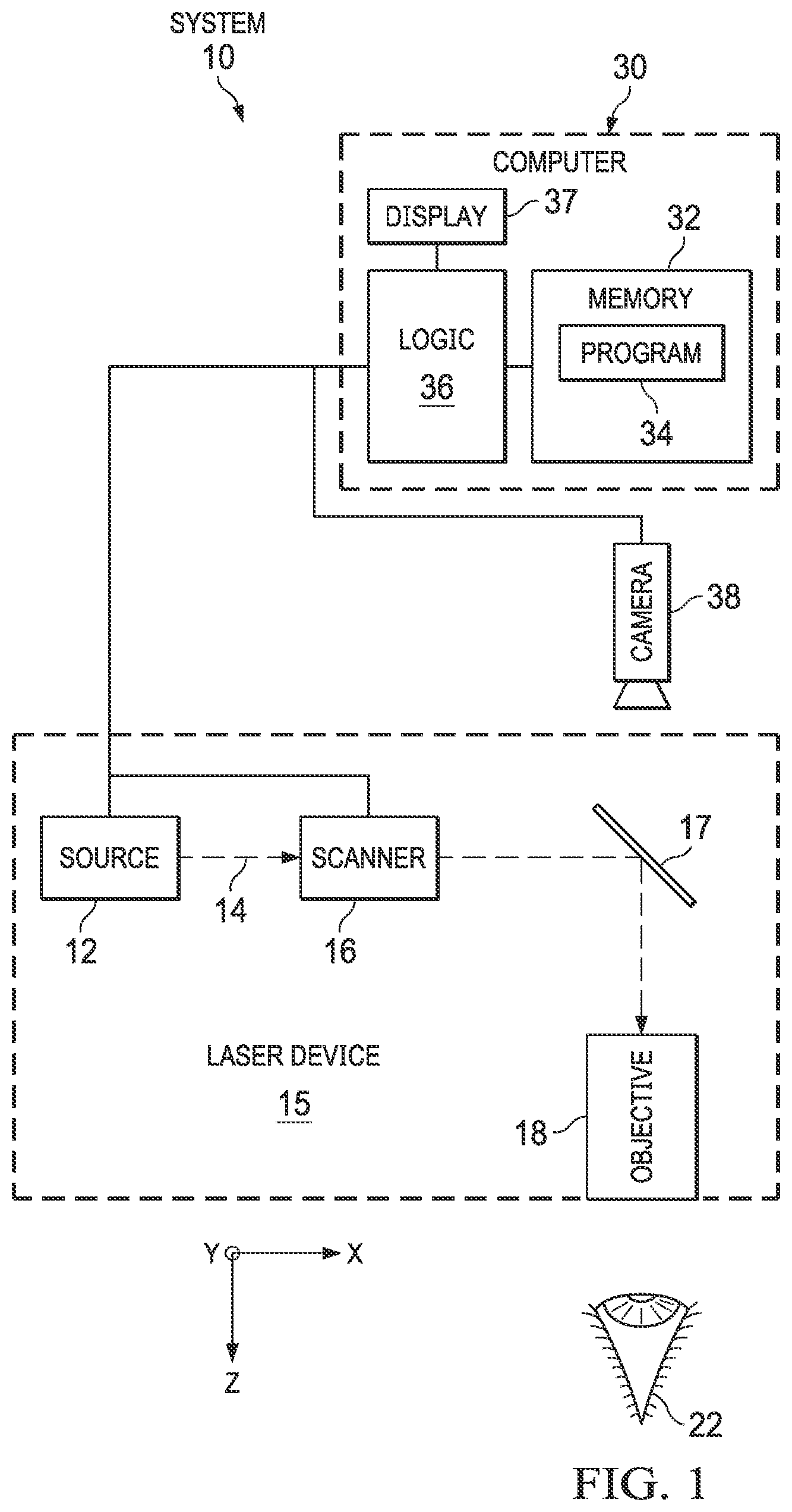 Patent US12472100 Figure 1 – Managing laser shot frequency for an ophthalmic surgical system