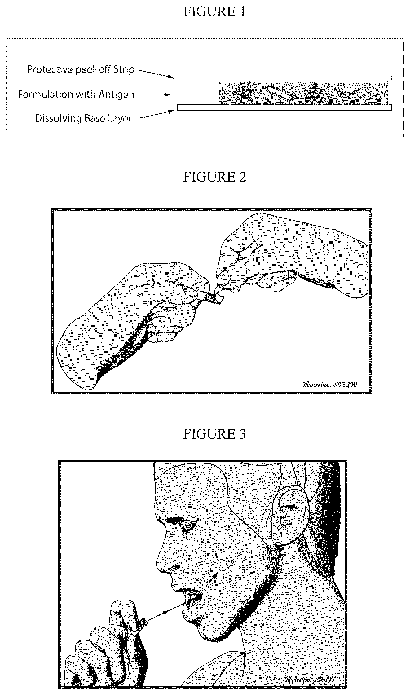 Patent US12472145 — Methods for inducing an immune response via buccal and/or sublingual administration of a vaccine — Figure 1