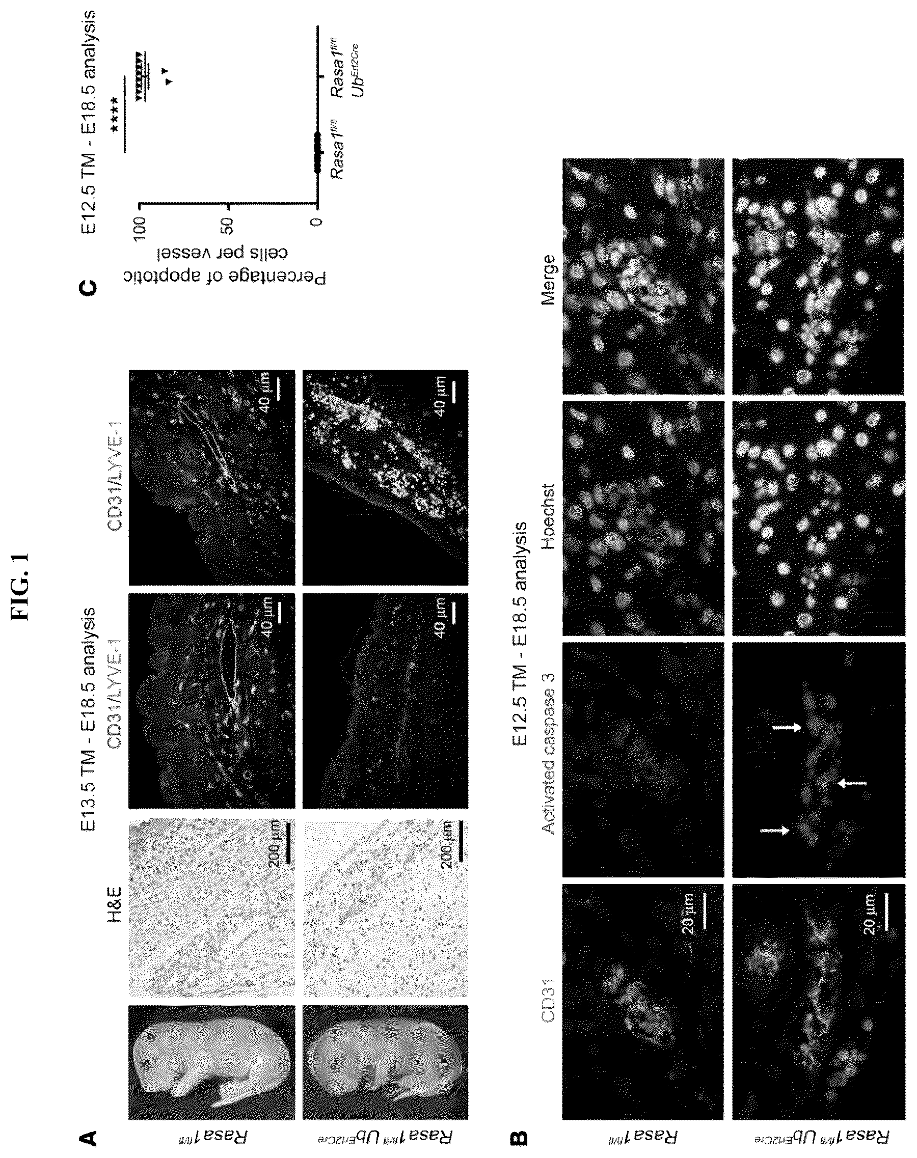 Patent US12472189 — Treatment and prevention of capillary malformation-arteriovenous malformation — Figure 1