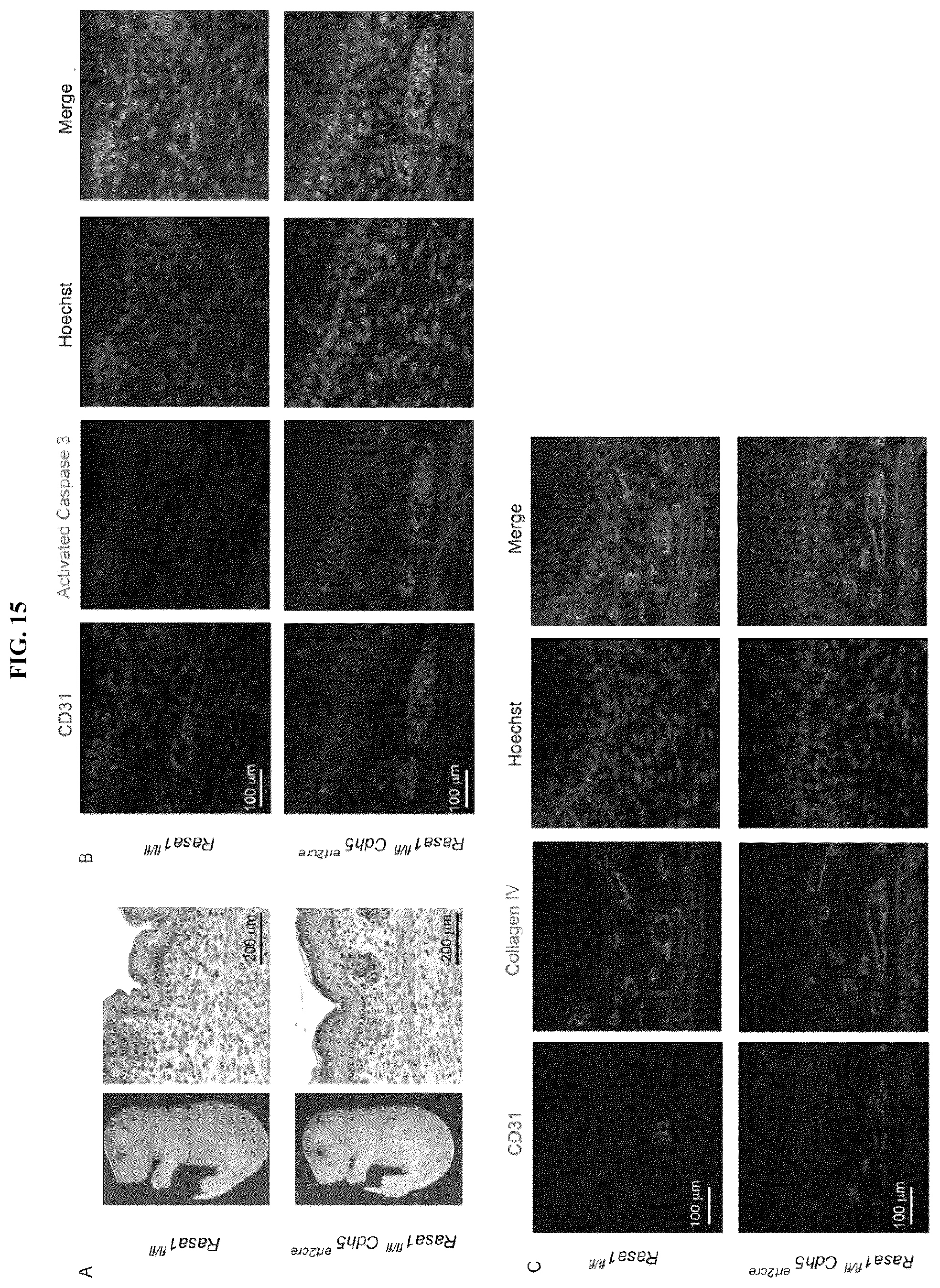 Patent US12472189 Figure 18 – Treatment and prevention of capillary malformation-arteriovenous malformation