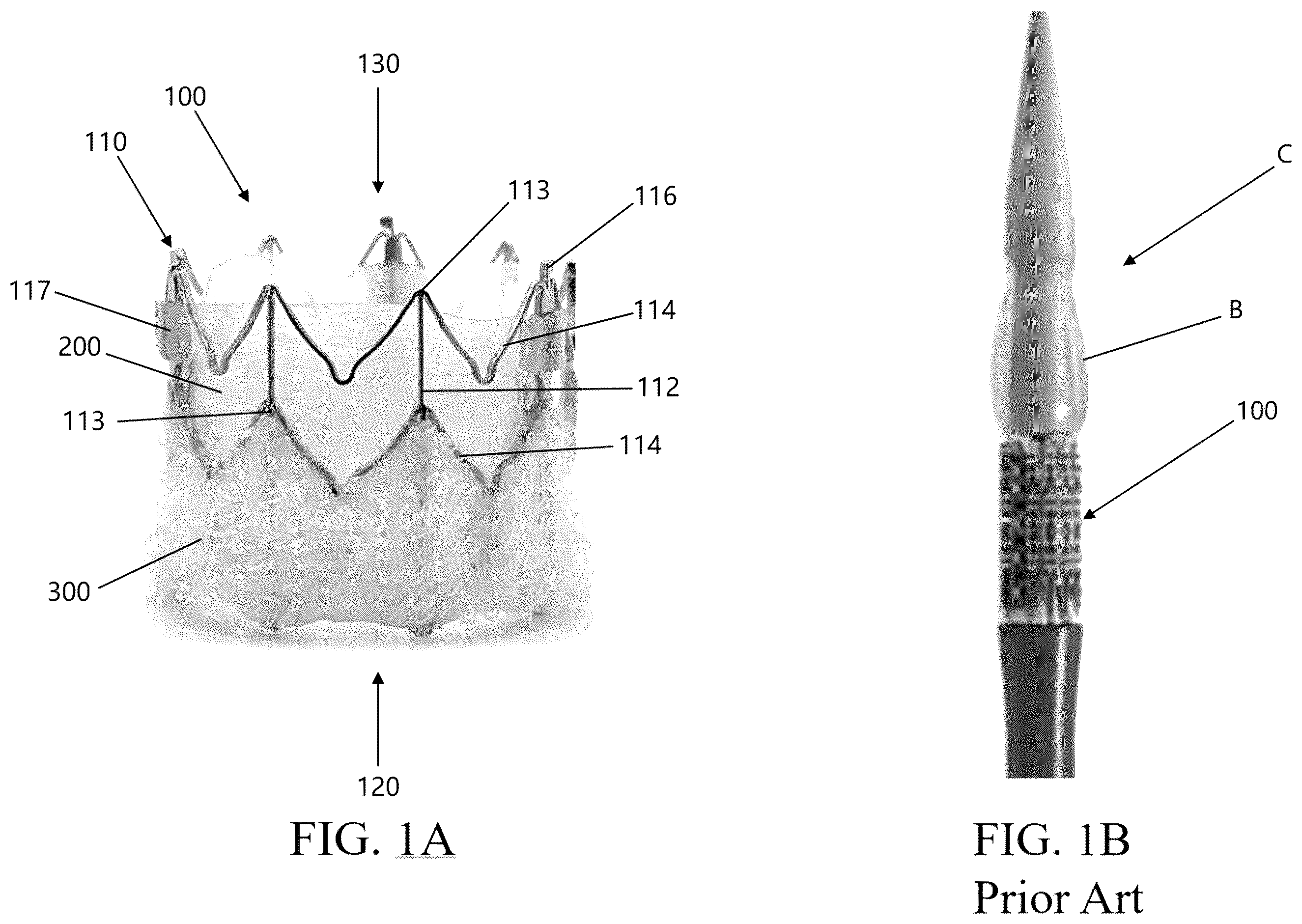 Patent US12472289 — Heart valve that includes coating material — Figure 1