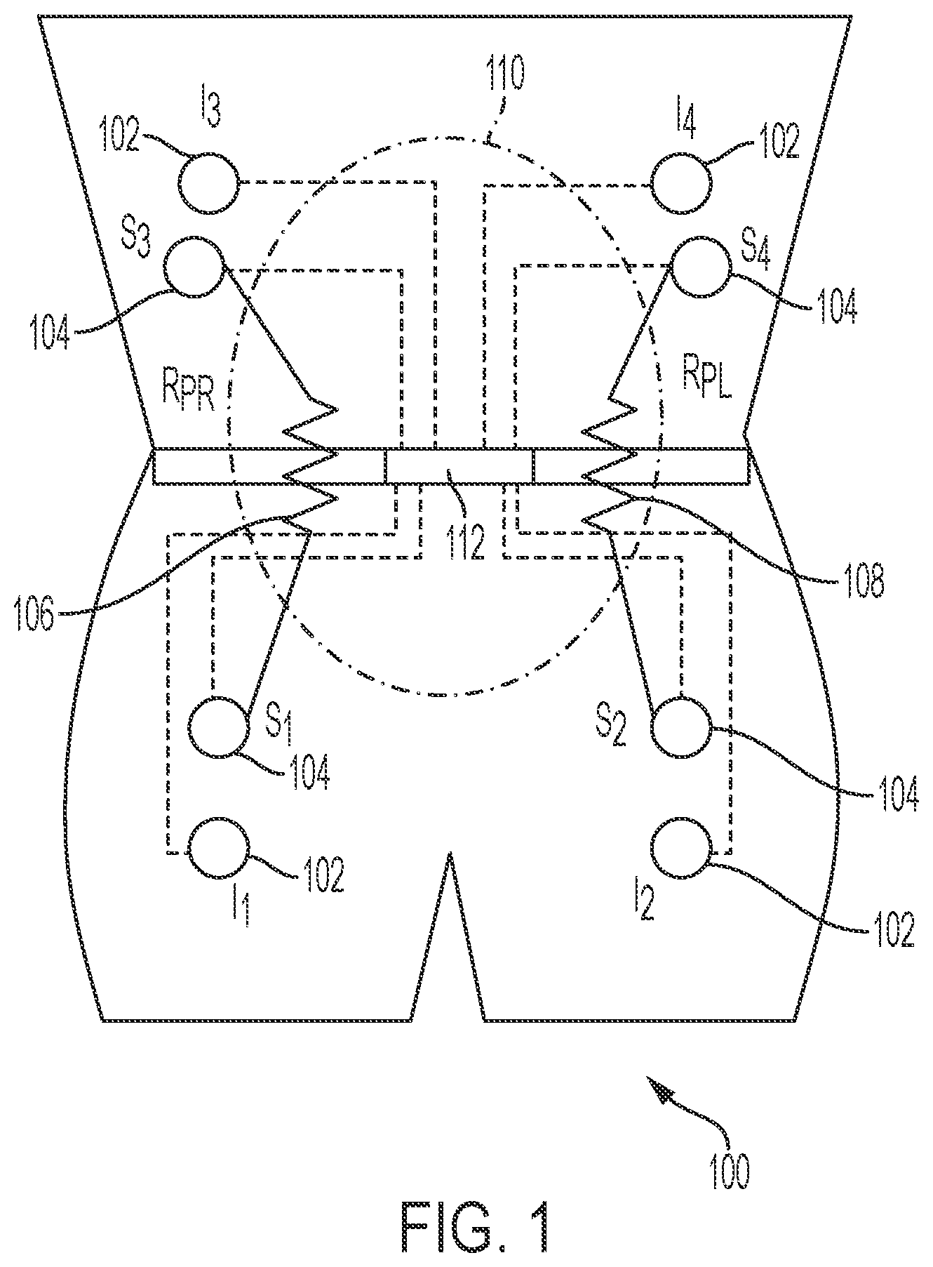 Patent US12472293 — Predicting ultrafiltration volume in peritoneal dialysis patients — Figure 1