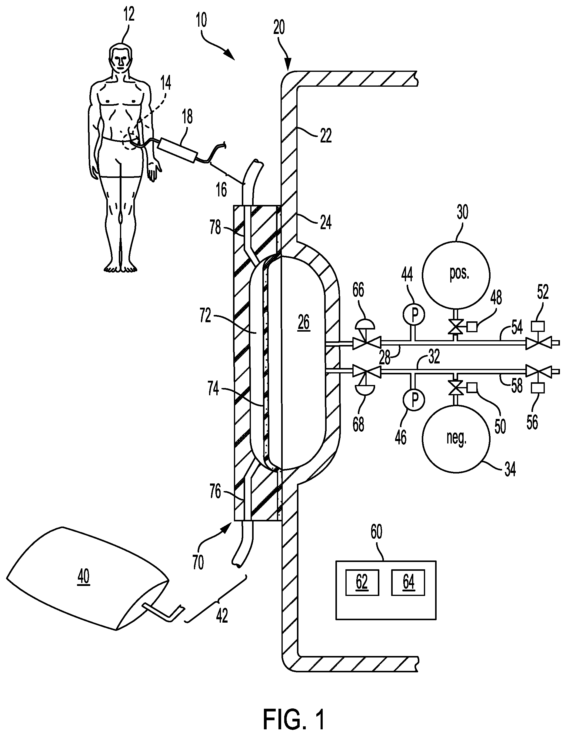 Patent US12472294 — Peritoneal dialysis system and method for minimizing patient drain pain — Figure 1