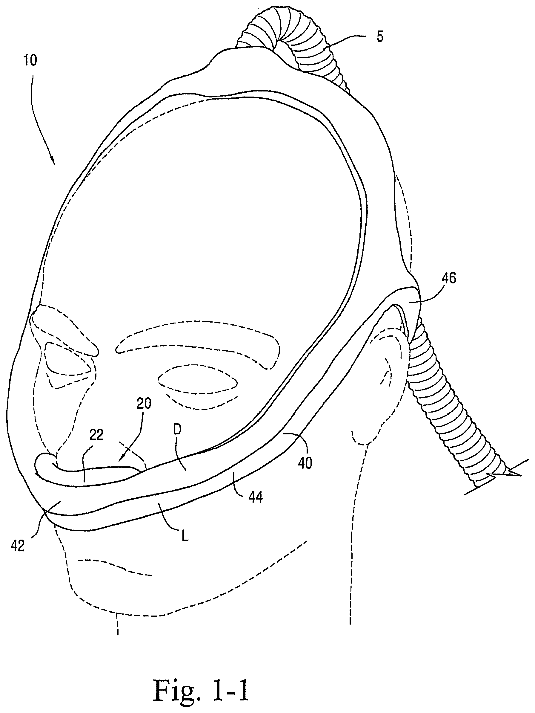 Patent US12472321 — Delivery of respiratory therapy — Figure 1