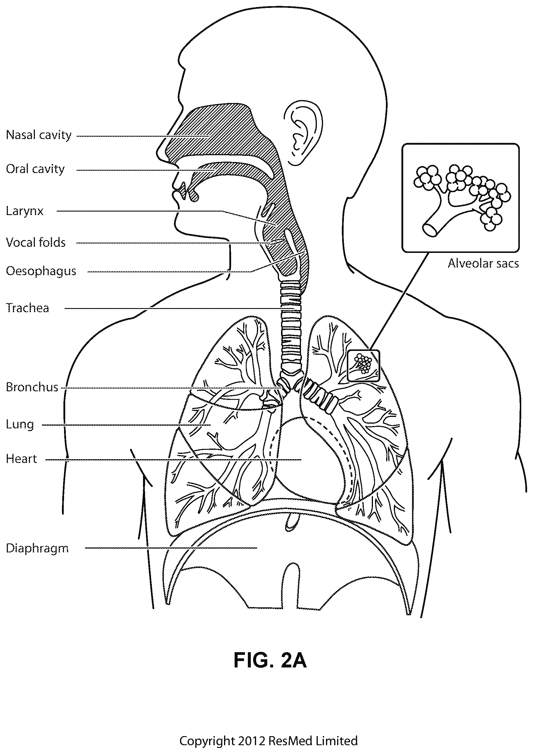 Patent US12472322 Figure 4 – Seal-forming structure for patient interface including textile seal member