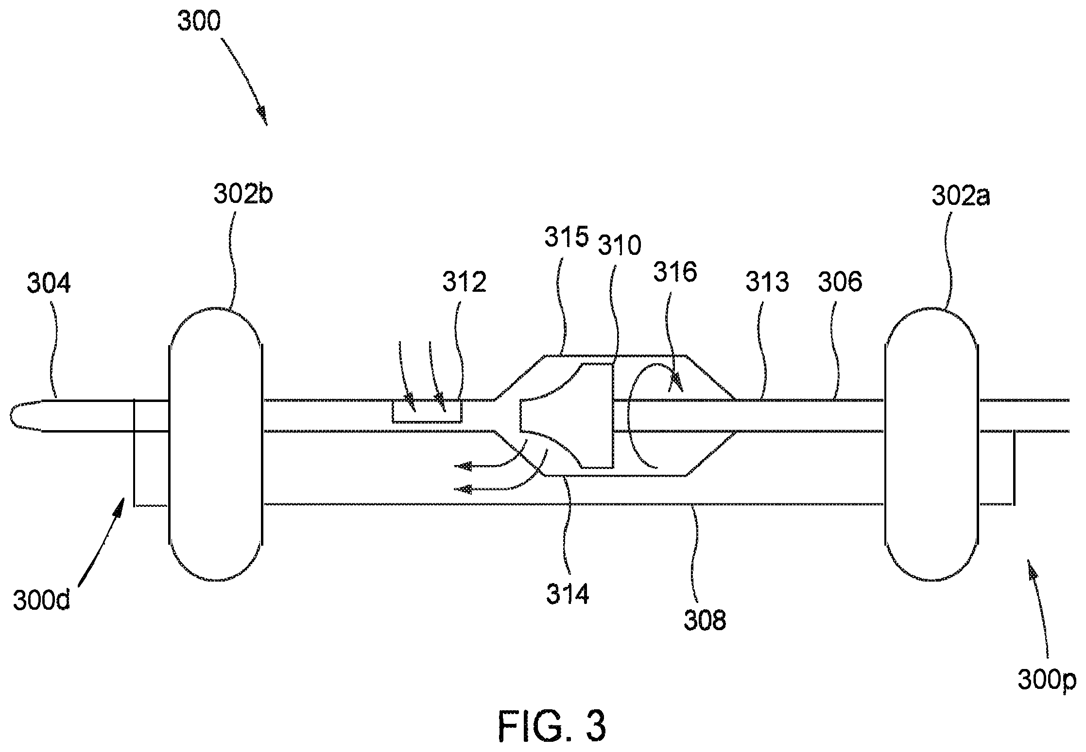 Patent US12472334 Figure 3 – Systems and methods for treatment of fluid overload