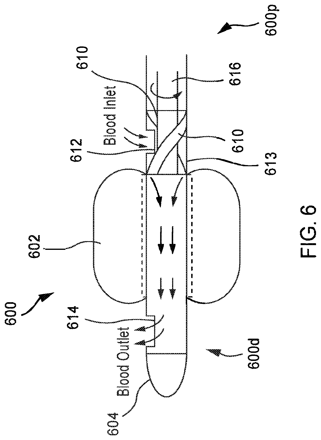 Patent US12472334 Figure 6 – Systems and methods for treatment of fluid overload