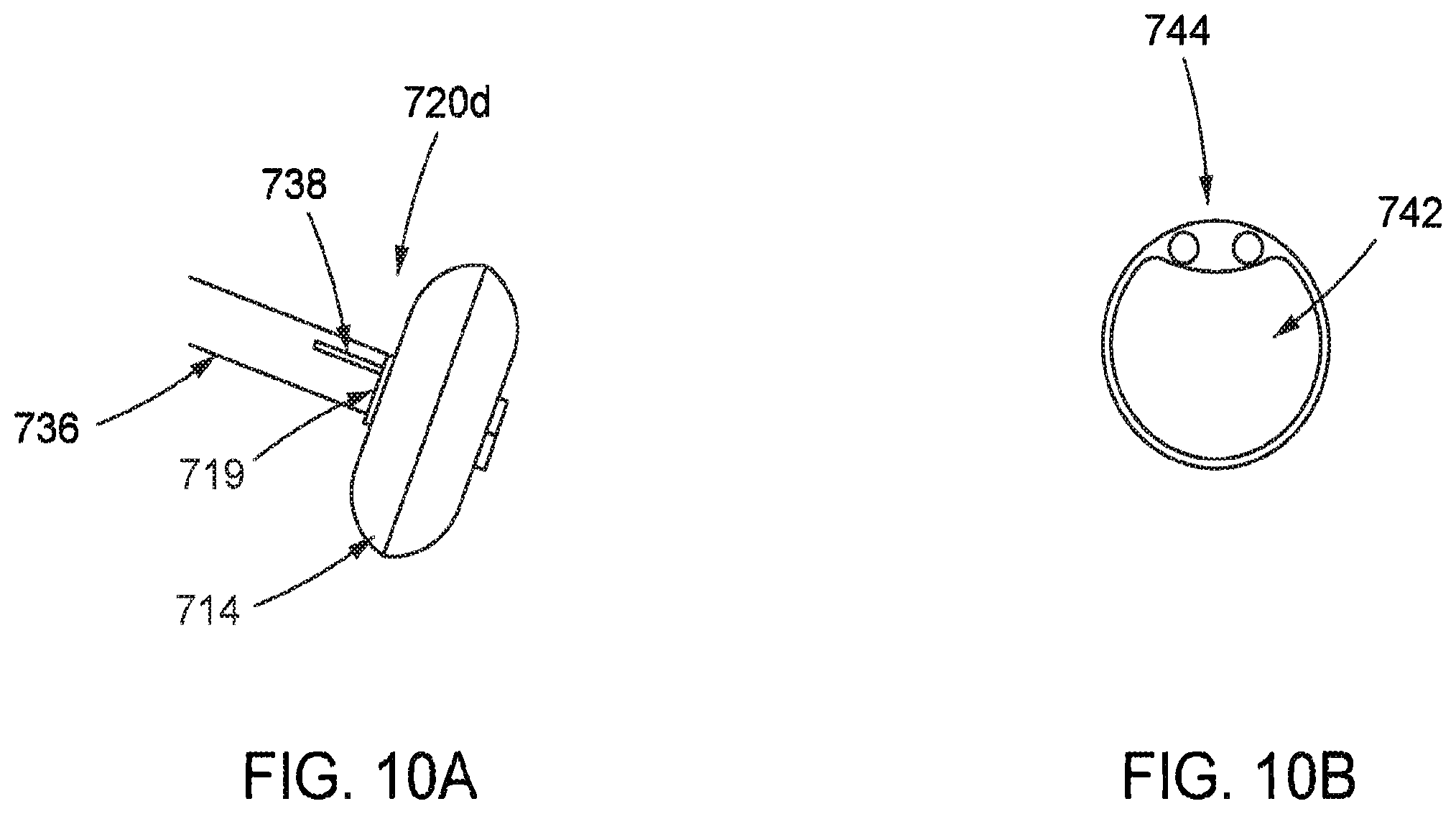 Patent US12472334 Figure 10 – Systems and methods for treatment of fluid overload