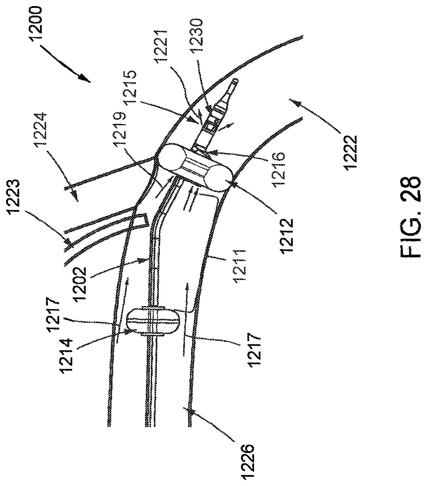 Patent US12472334 Figure 19 – Systems and methods for treatment of fluid overload