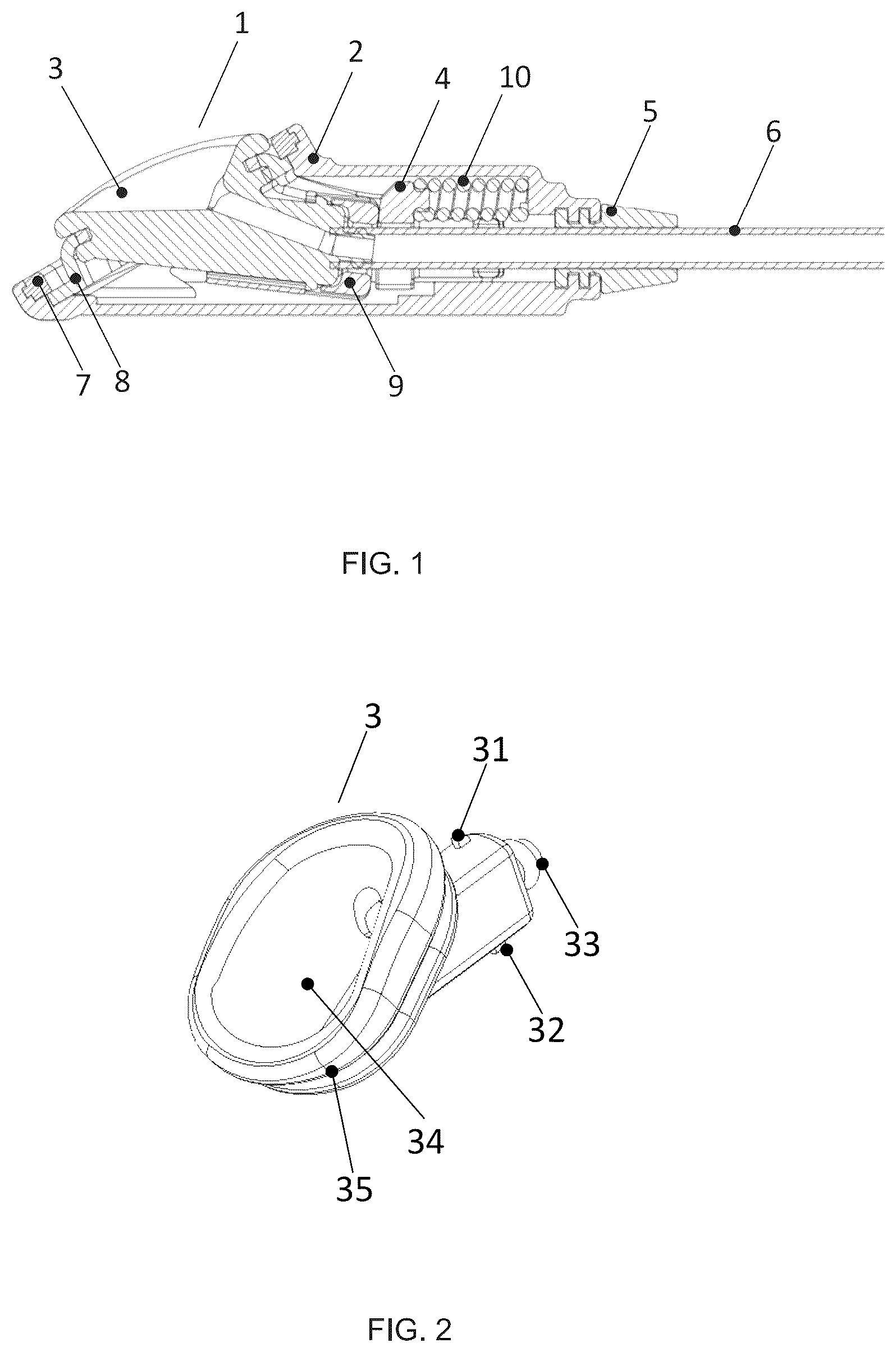 Patent US12472339 Figure 1 – Implantable access device for accessing the vascular system of a human or animal body, particularly subcutaneously implantable access port