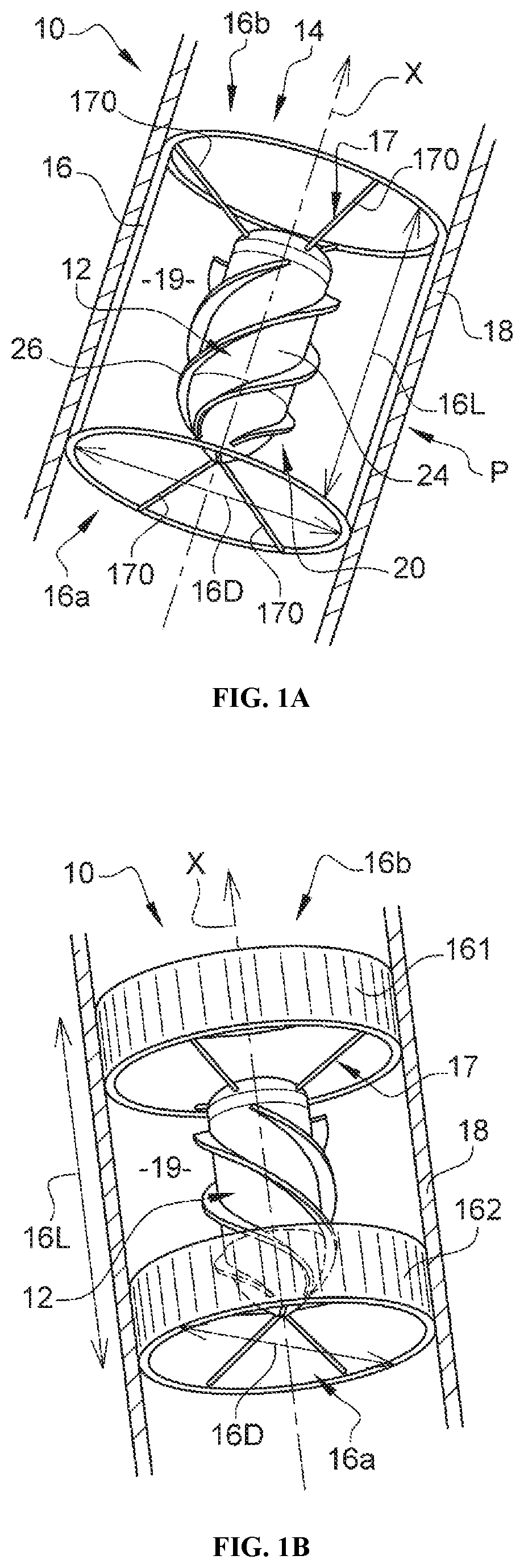 Patent US12472344 — Left ventricle unloading device — Figure 1