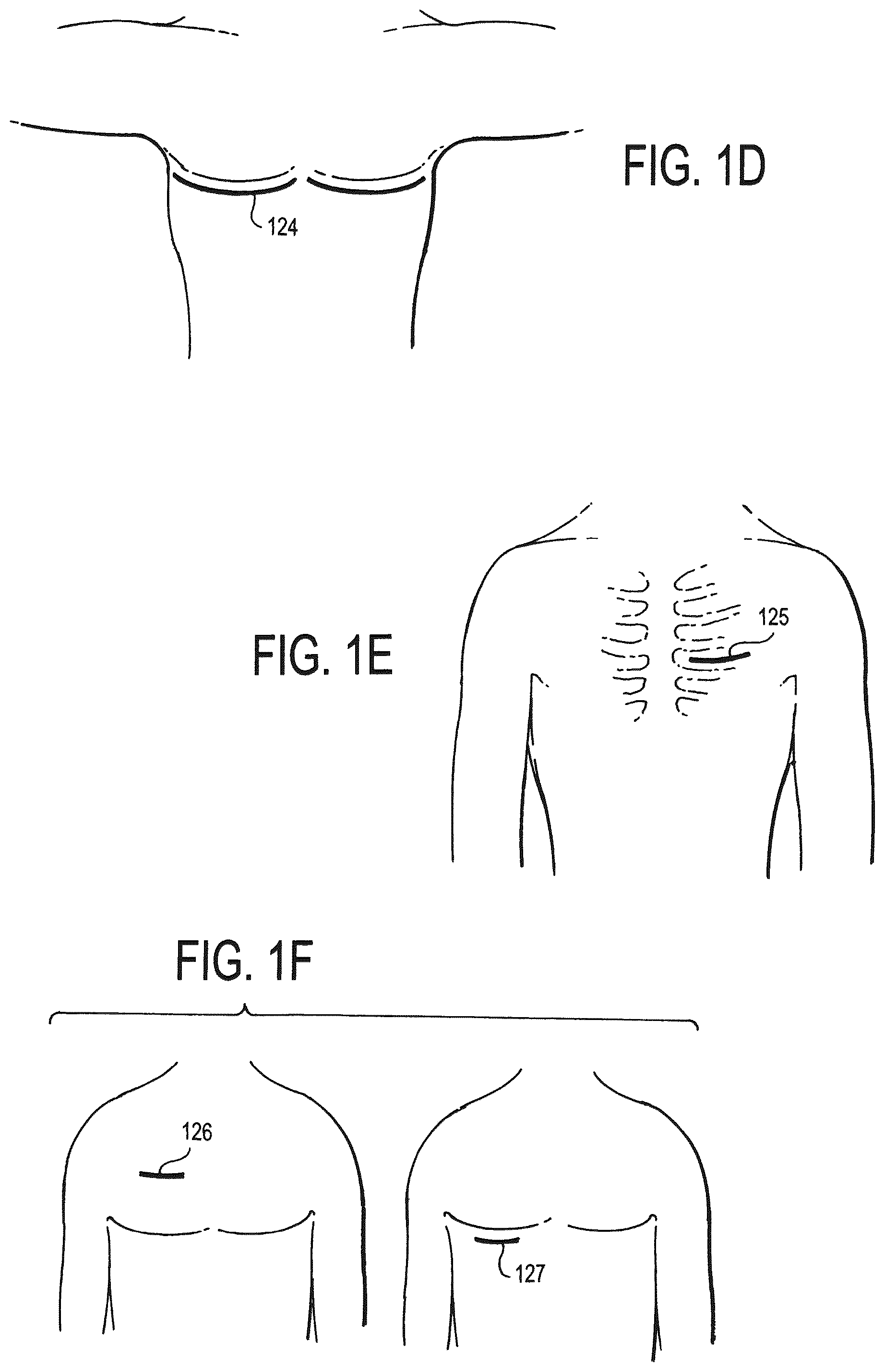 Patent US12472346 Figure 2 – Configurable electrodes and sensors