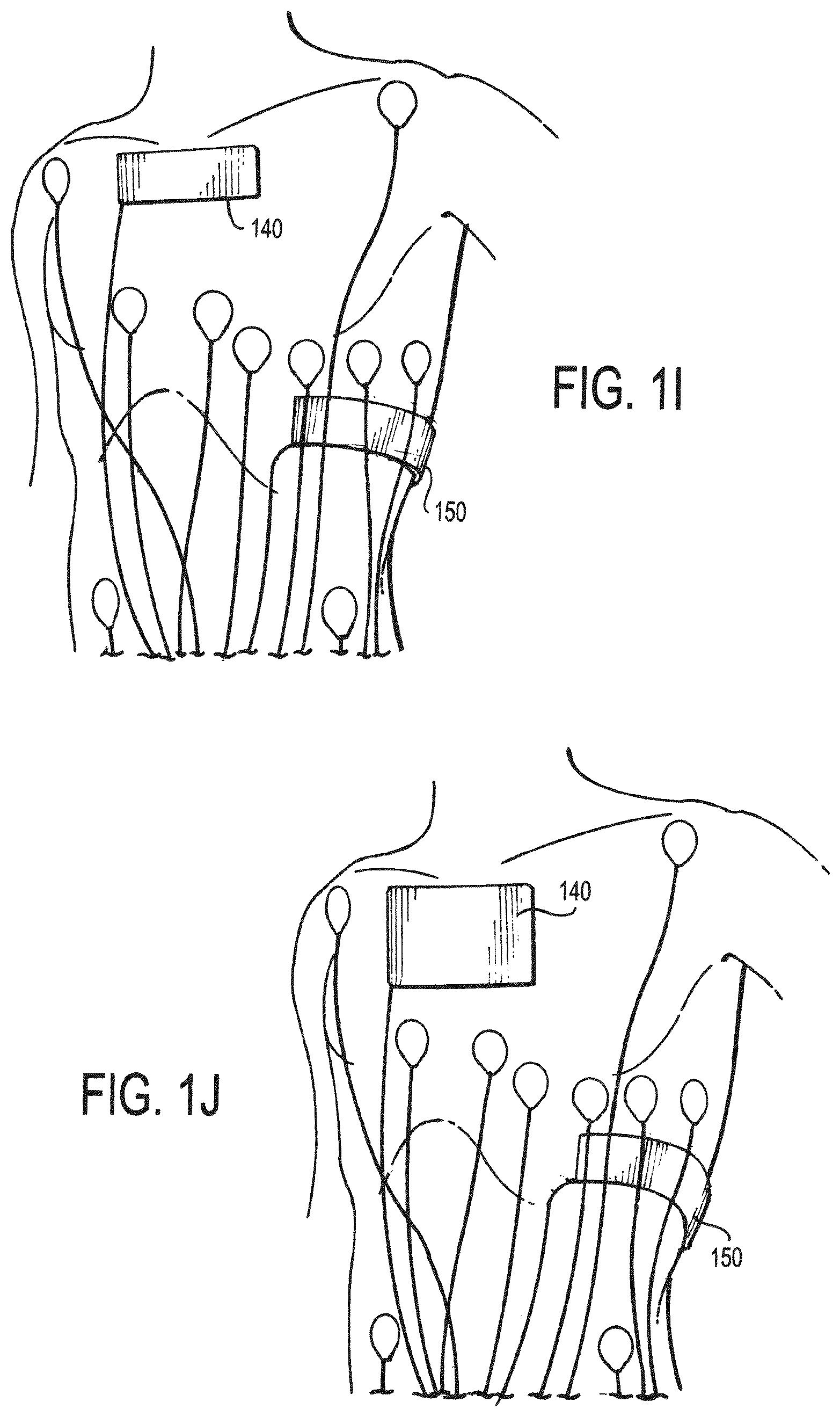 Patent US12472346 Figure 4 – Configurable electrodes and sensors