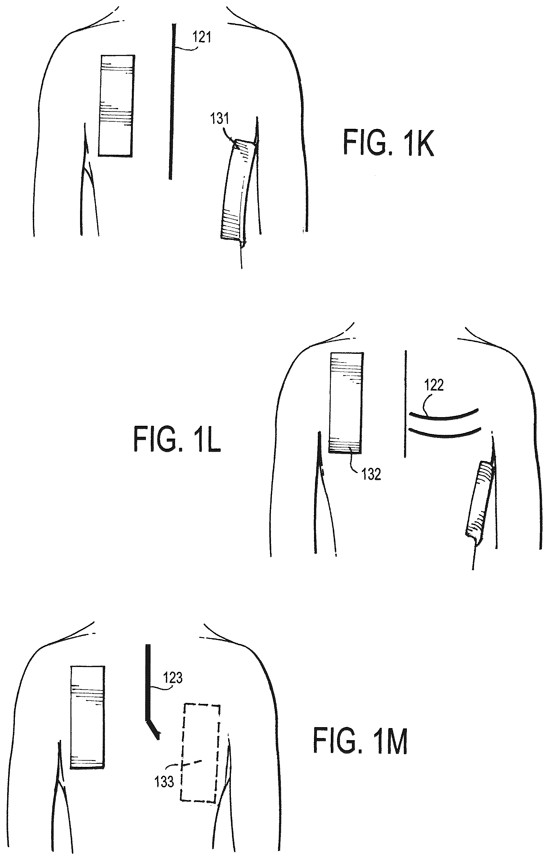 Patent US12472346 Figure 5 – Configurable electrodes and sensors