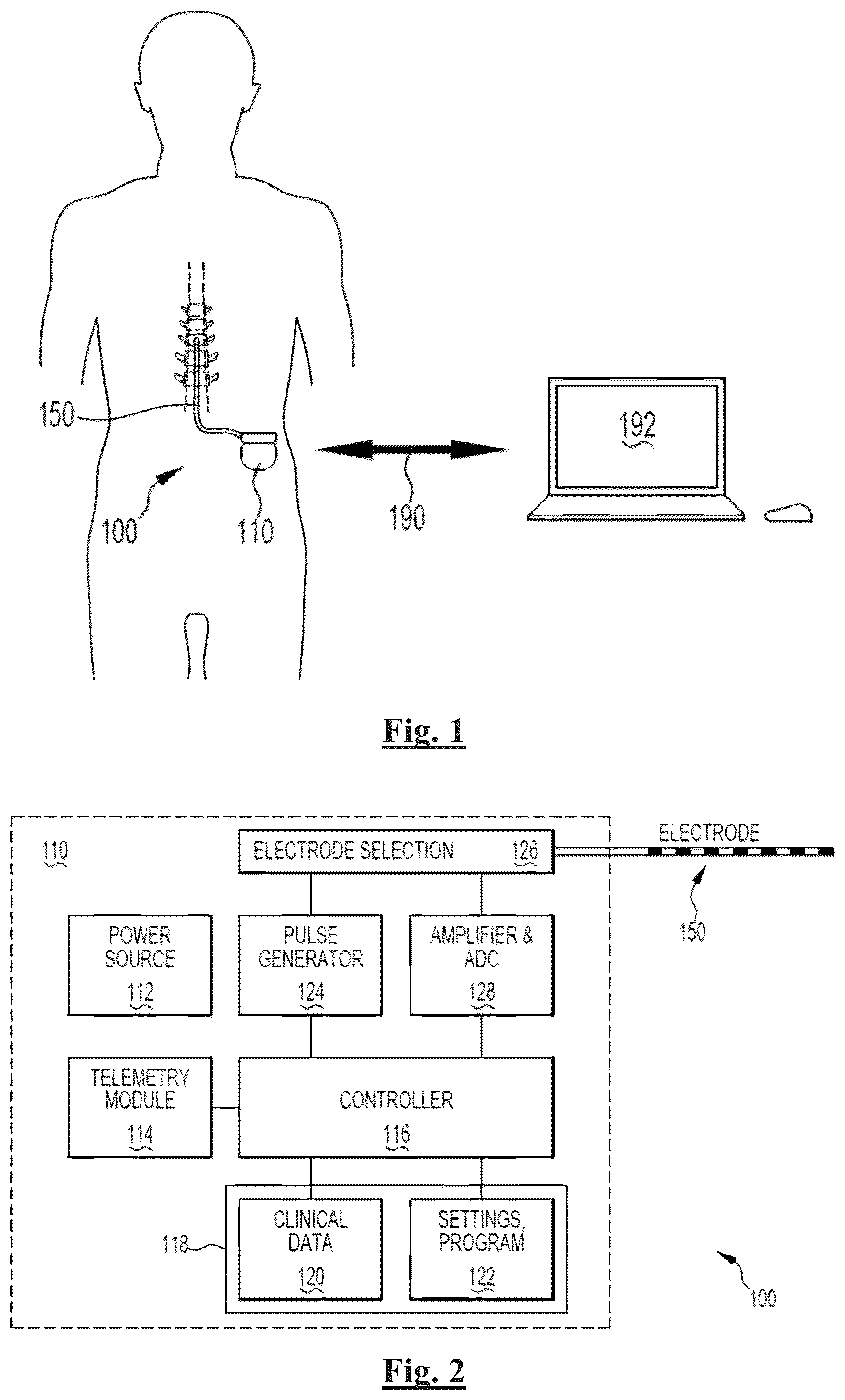 Patent US12472349 — Neurostimulation responsive to posture — Figure 1