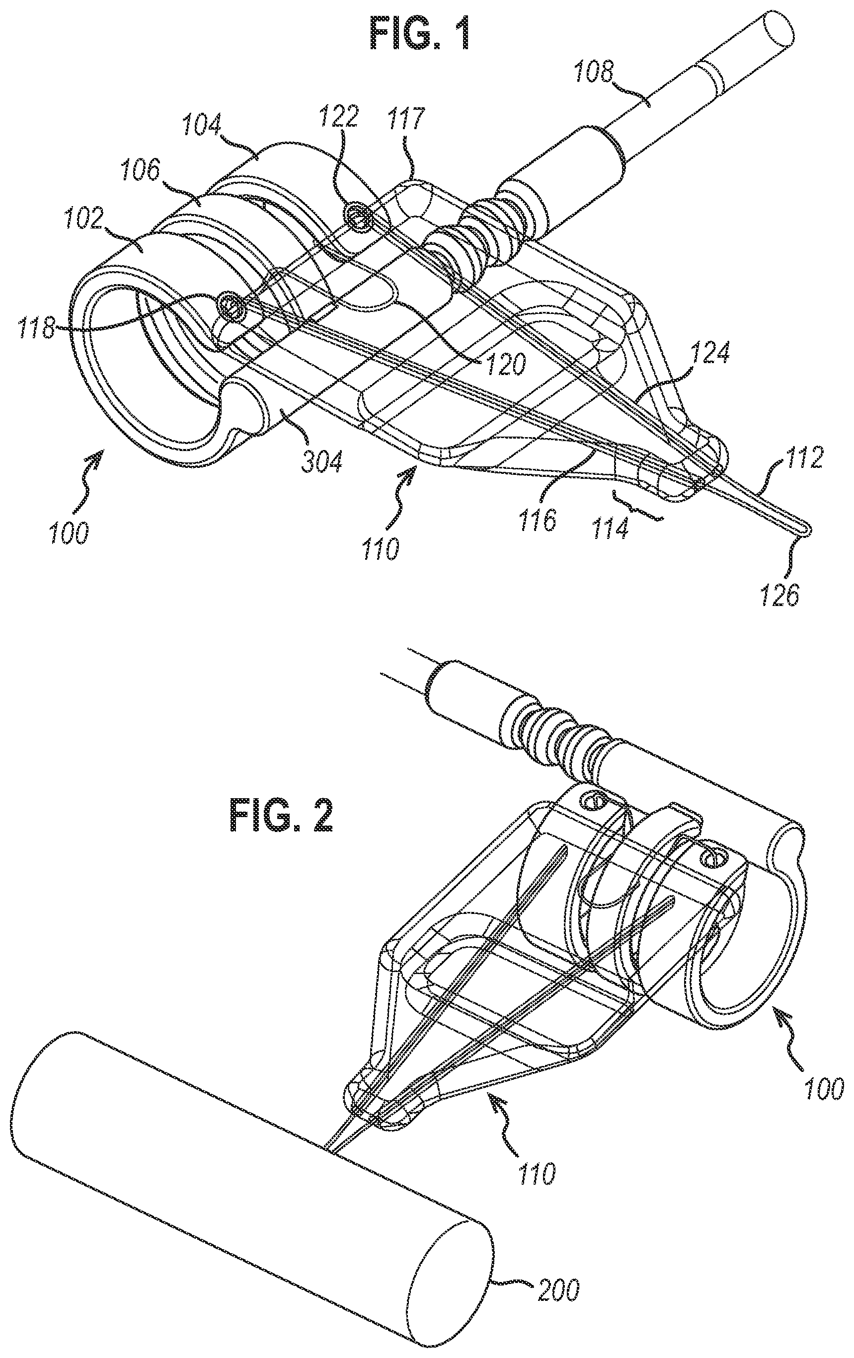 Patent US12472350 — Systems and methods for laparoscopic delivery and deployment of a neural interface — Figure 1