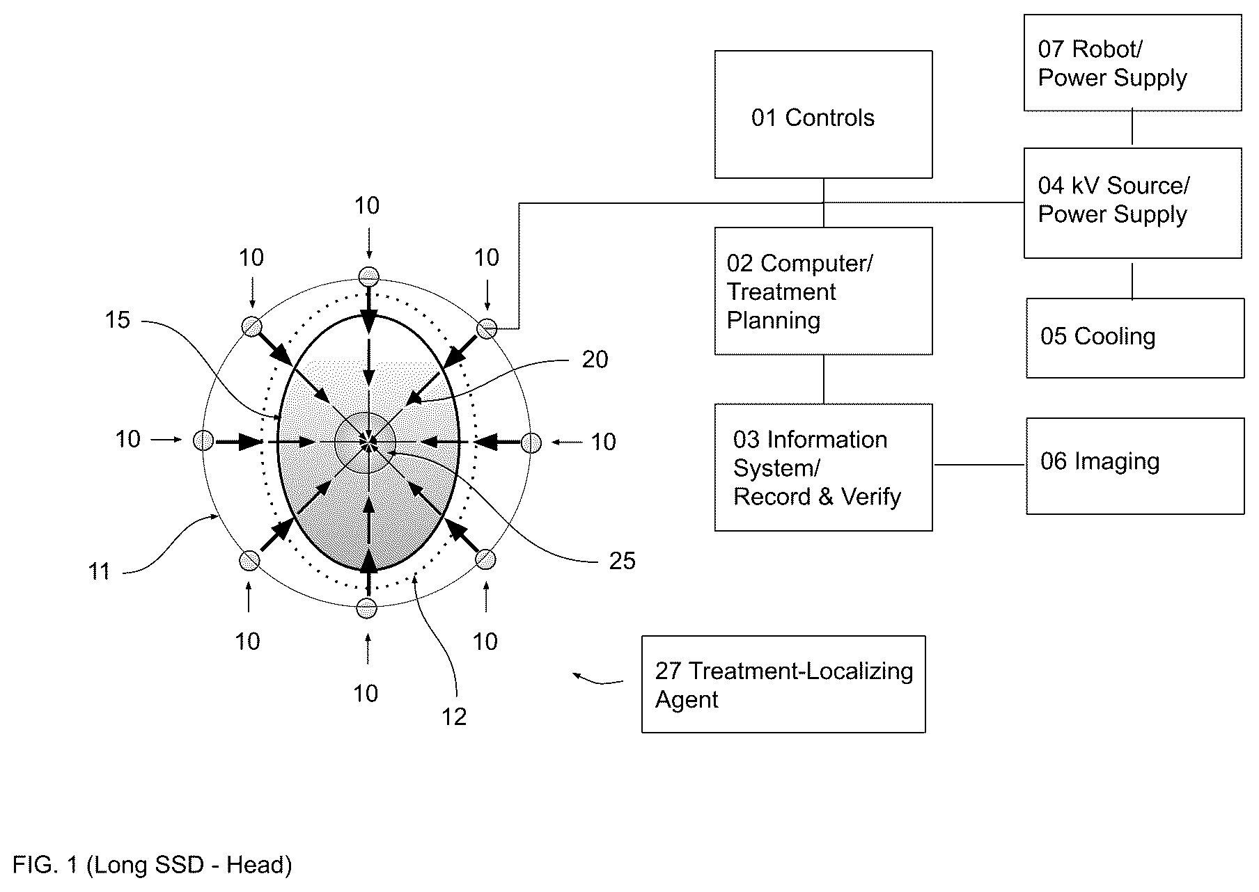 Patent US12472380 — Gradient optimized radial treatment (GORT) — Figure 1