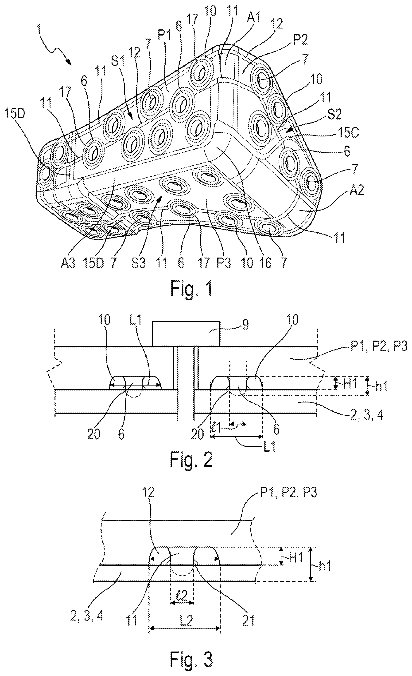 Patent US12479562 — Flexible corner fitting intended to contribute to a connection between at least three walls of at least one aircraft box structure — Figure 1