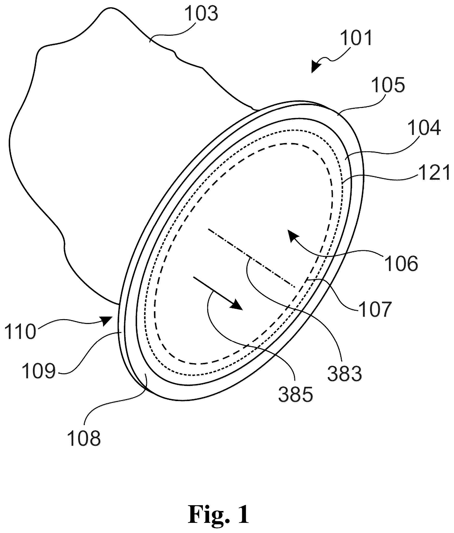 Patent US12479671 — Connection device for transferring bulk material goods and port system — Figure 1