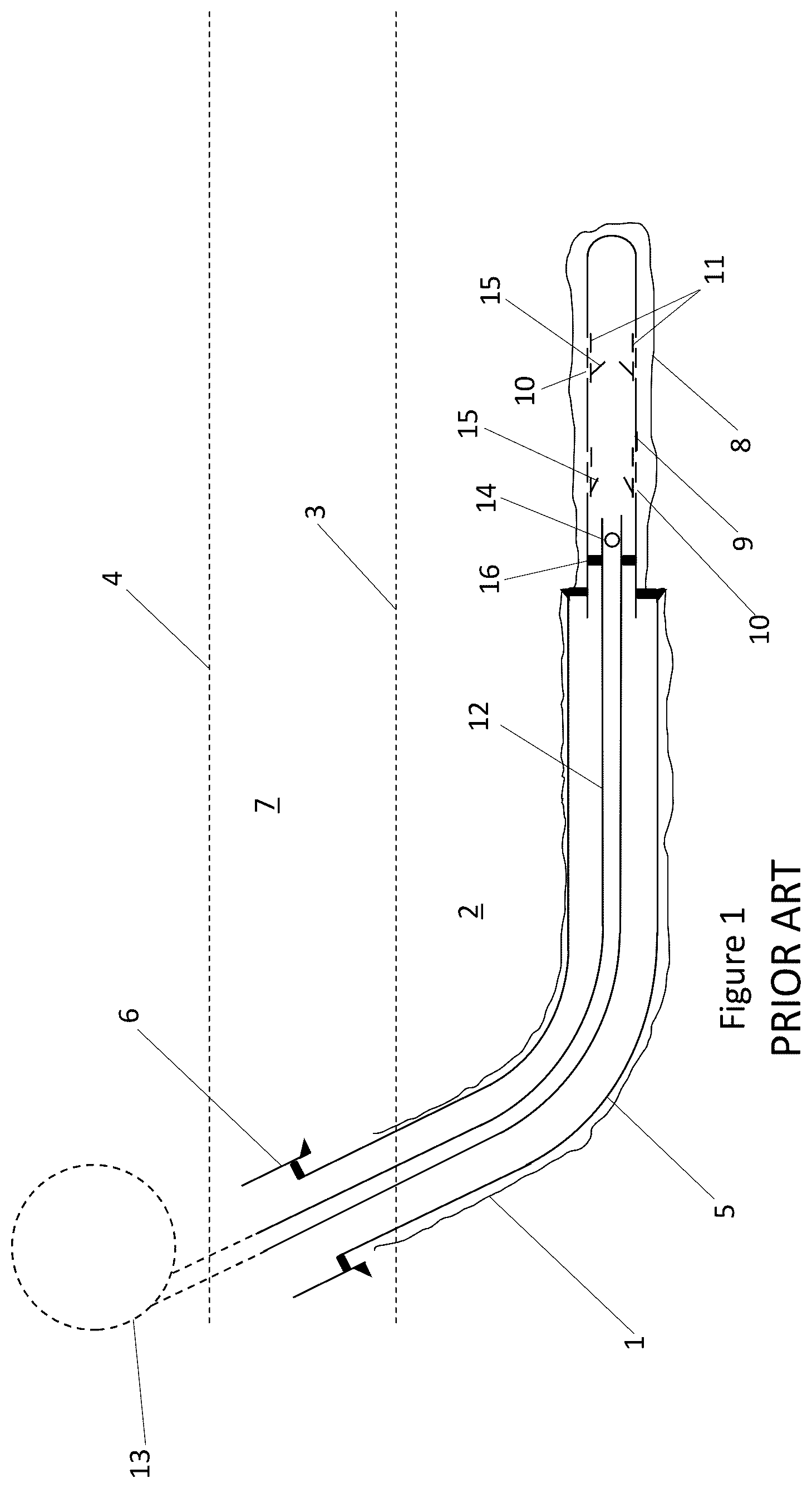 Patent US12480394 — Method and apparatus for acid stimulation — Figure 1
