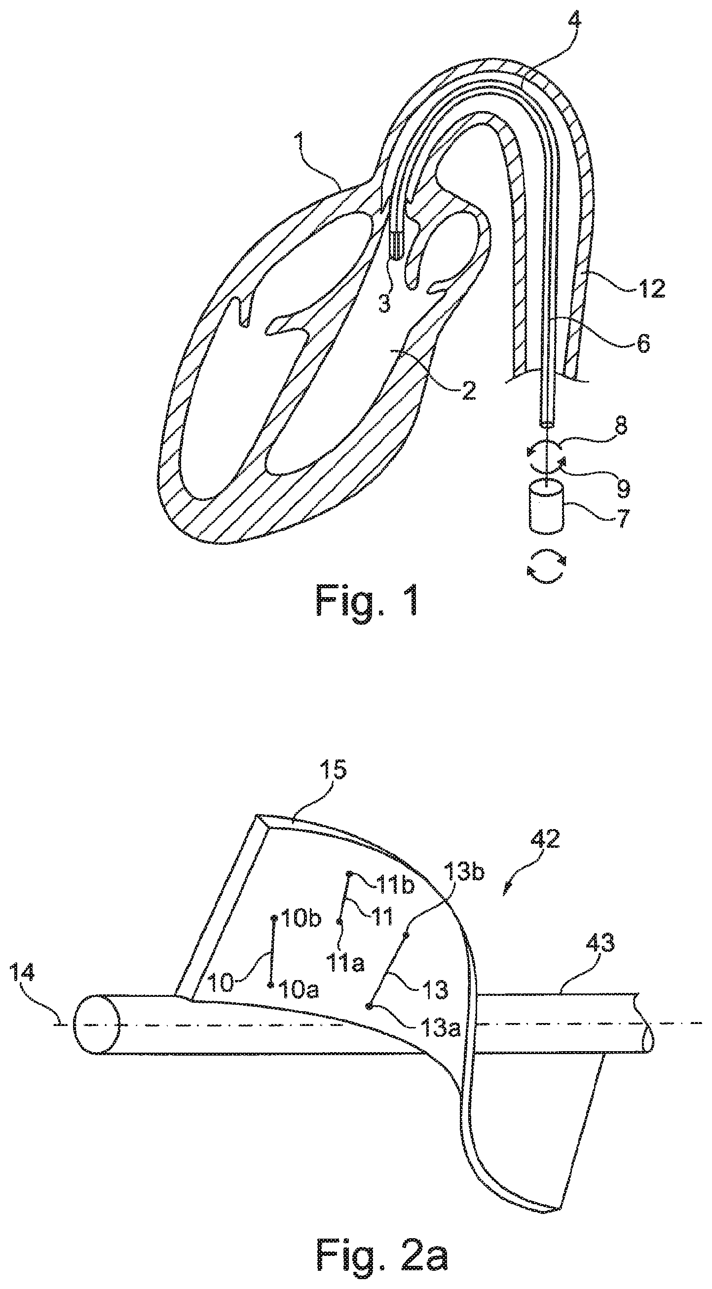 Patent US12480512 — Rotor for a fluid pump and method and mold for the production thereof — Figure 1
