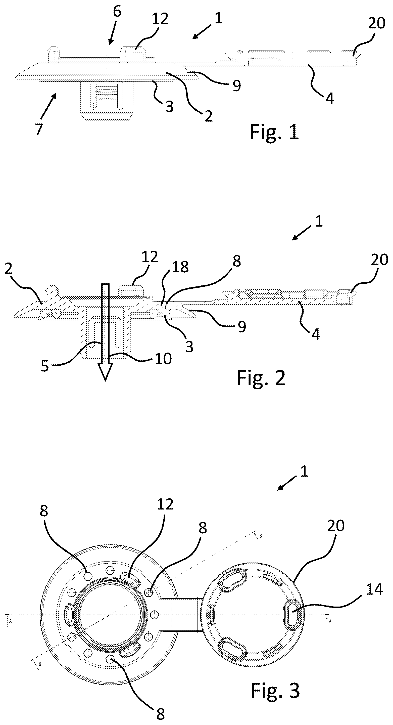 Patent US12480592 — Apparatus for sealingly connecting to an opening of a carrier component — Figure 1