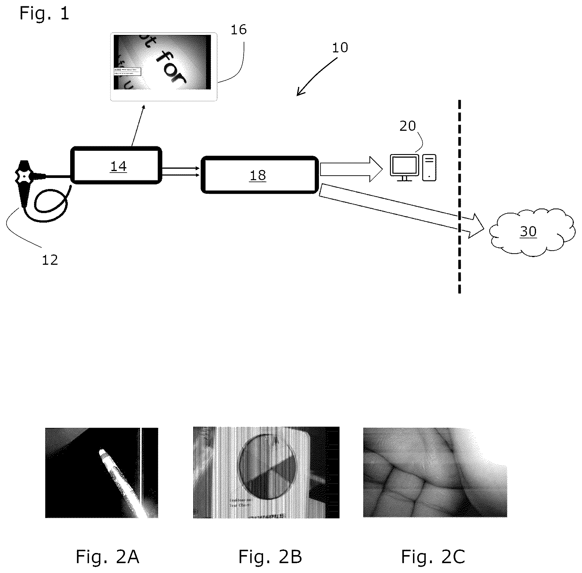Patent US12488444 — Method, software program and system for detecting image irregularities in video endoscopic instrument produced images — Figure 1