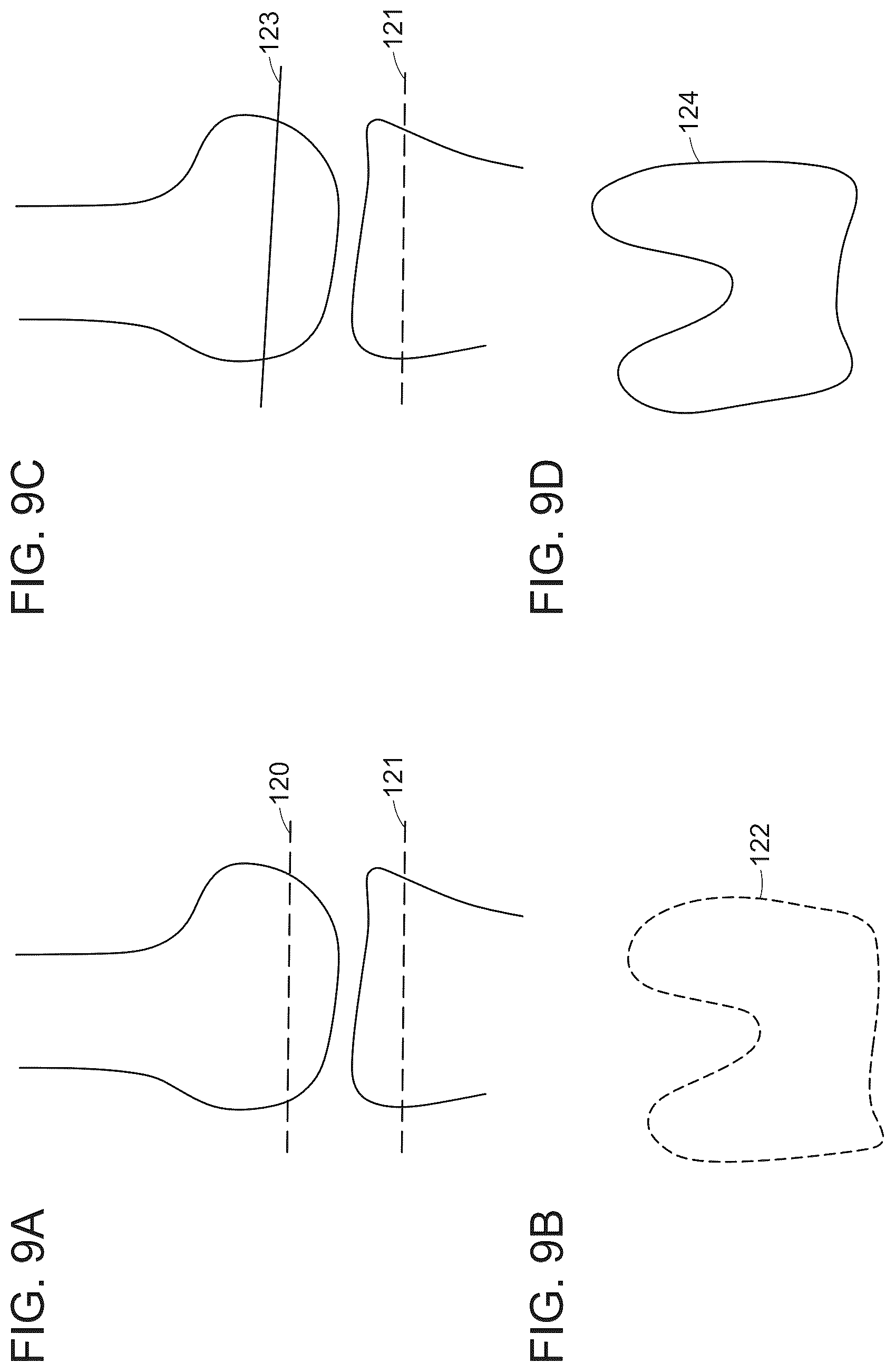 Patent US12488480 Figure 12 – Augmented reality guidance for surgical procedures