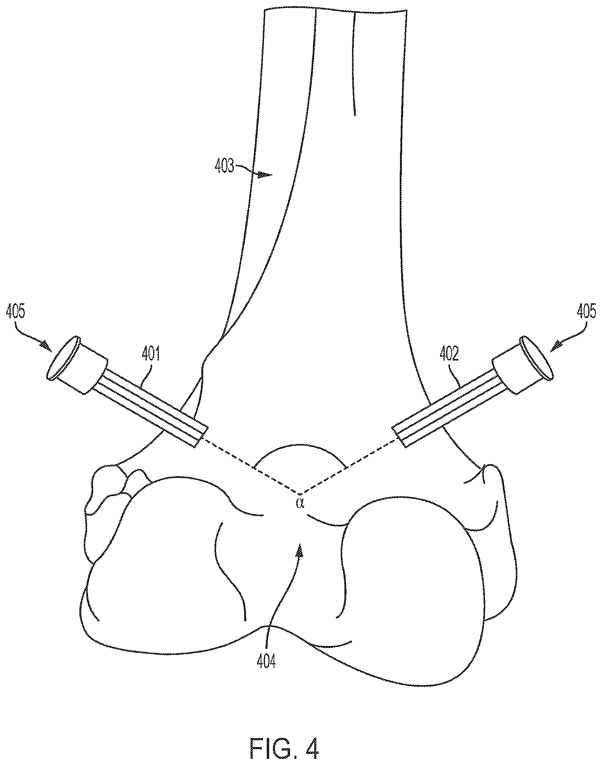 Patent US12488588 Figure 4 – Methods for arthroscopic video analysis and devices therefor