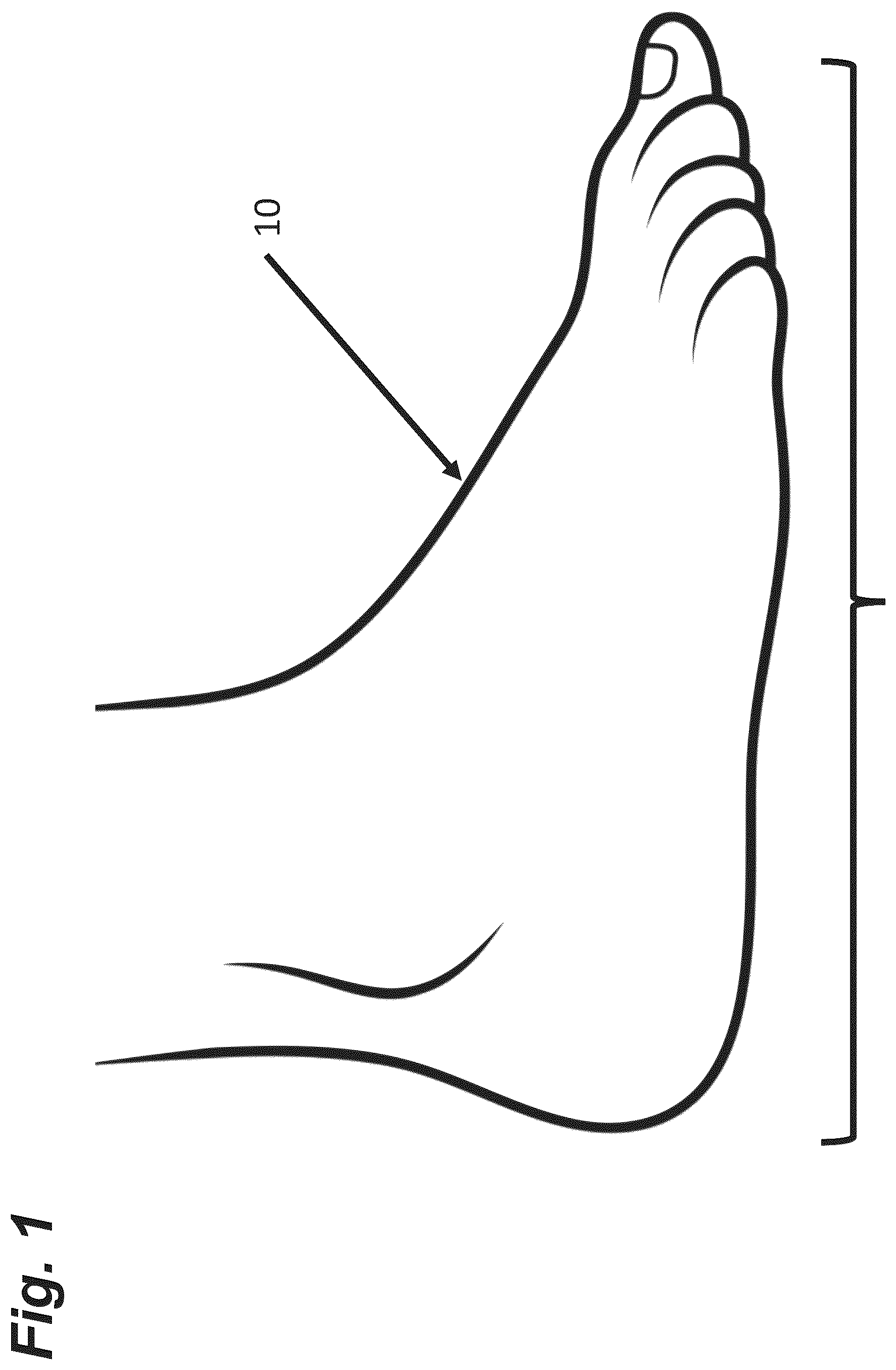 Patent US12496007 — Apparatus and method for monitoring peripheral diabetic neuropathy and/or peripheral arterial disease — Figure 1