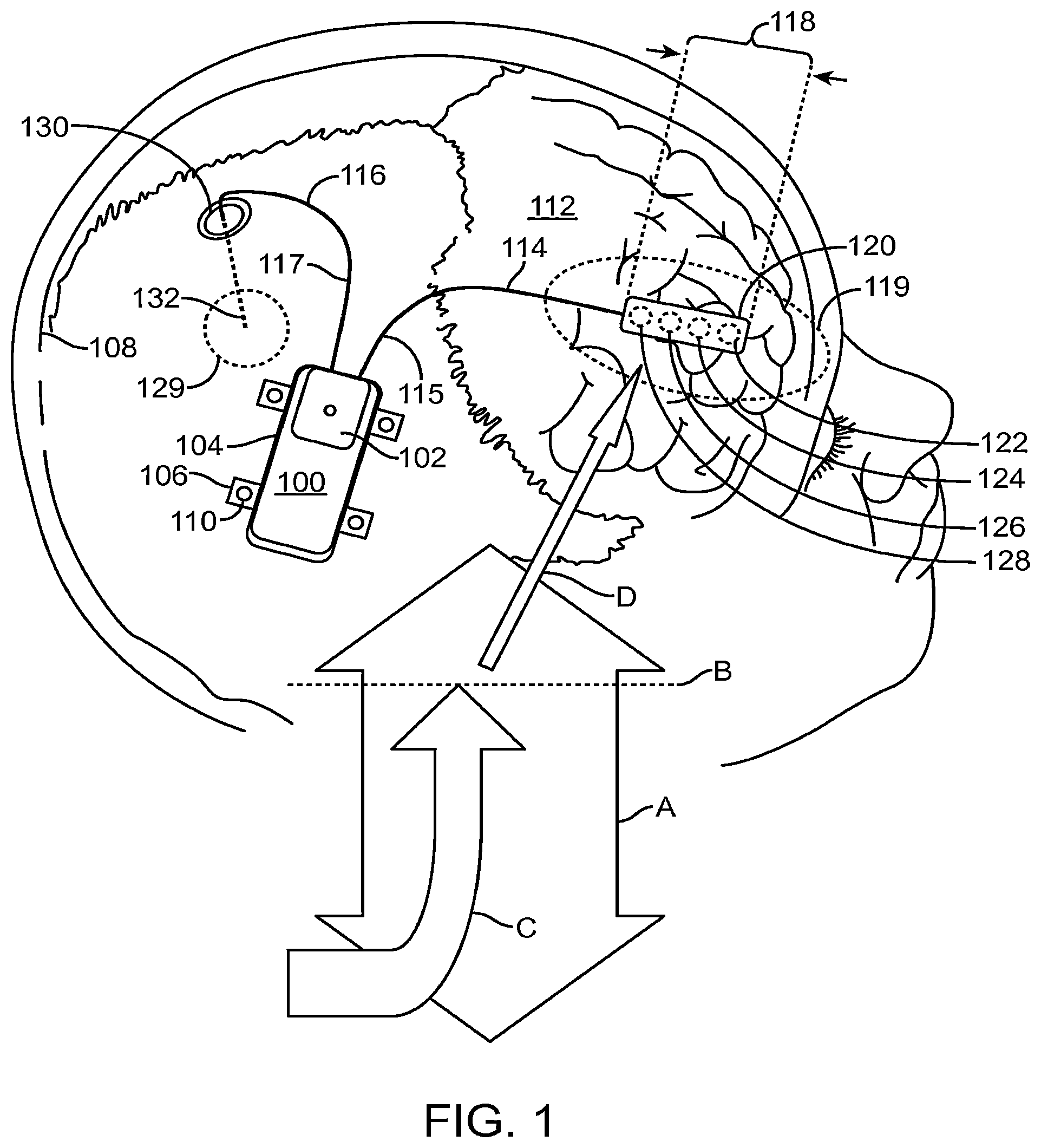 Patent US12496011 — Systems and methods for assessing the effectiveness of a therapy including a drug regimen using an implantable medical device — Figure 1