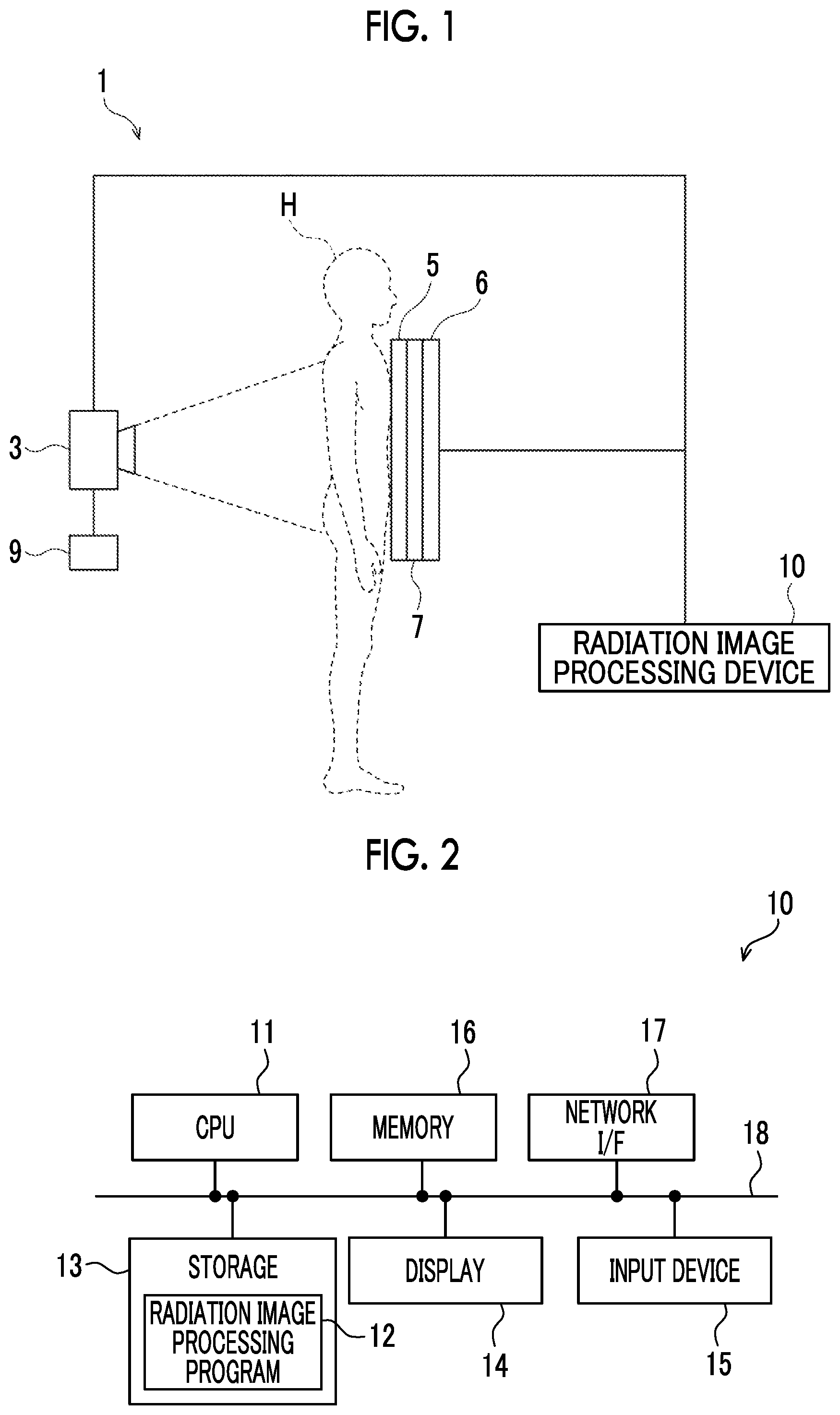 Patent US12496028 — Radiation image processing device, radiation image processing method, and radiation image processing program — Figure 1